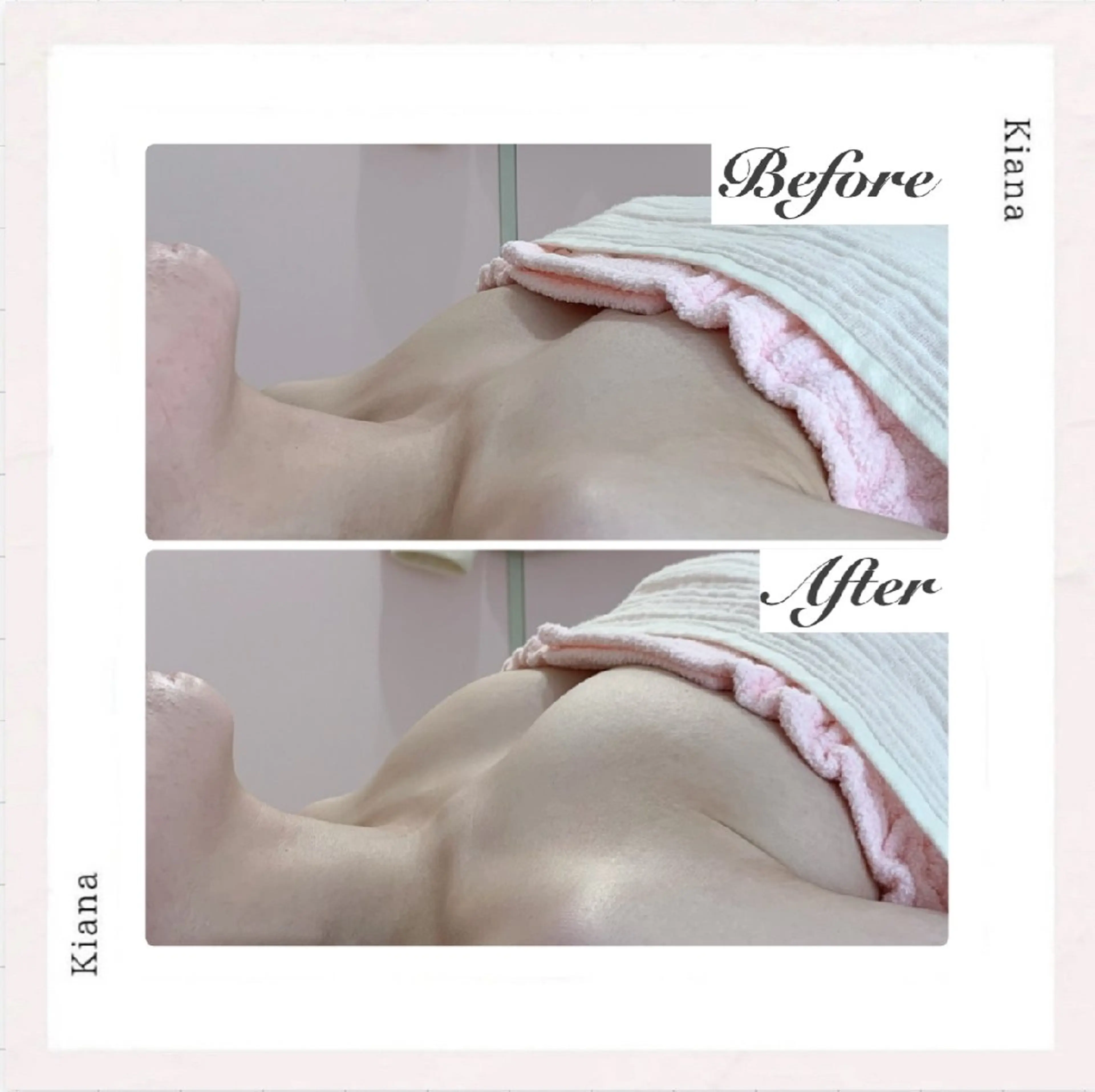 エステ リラク 【バスト専門店 】 Kiana のエステ・リラクイメージ