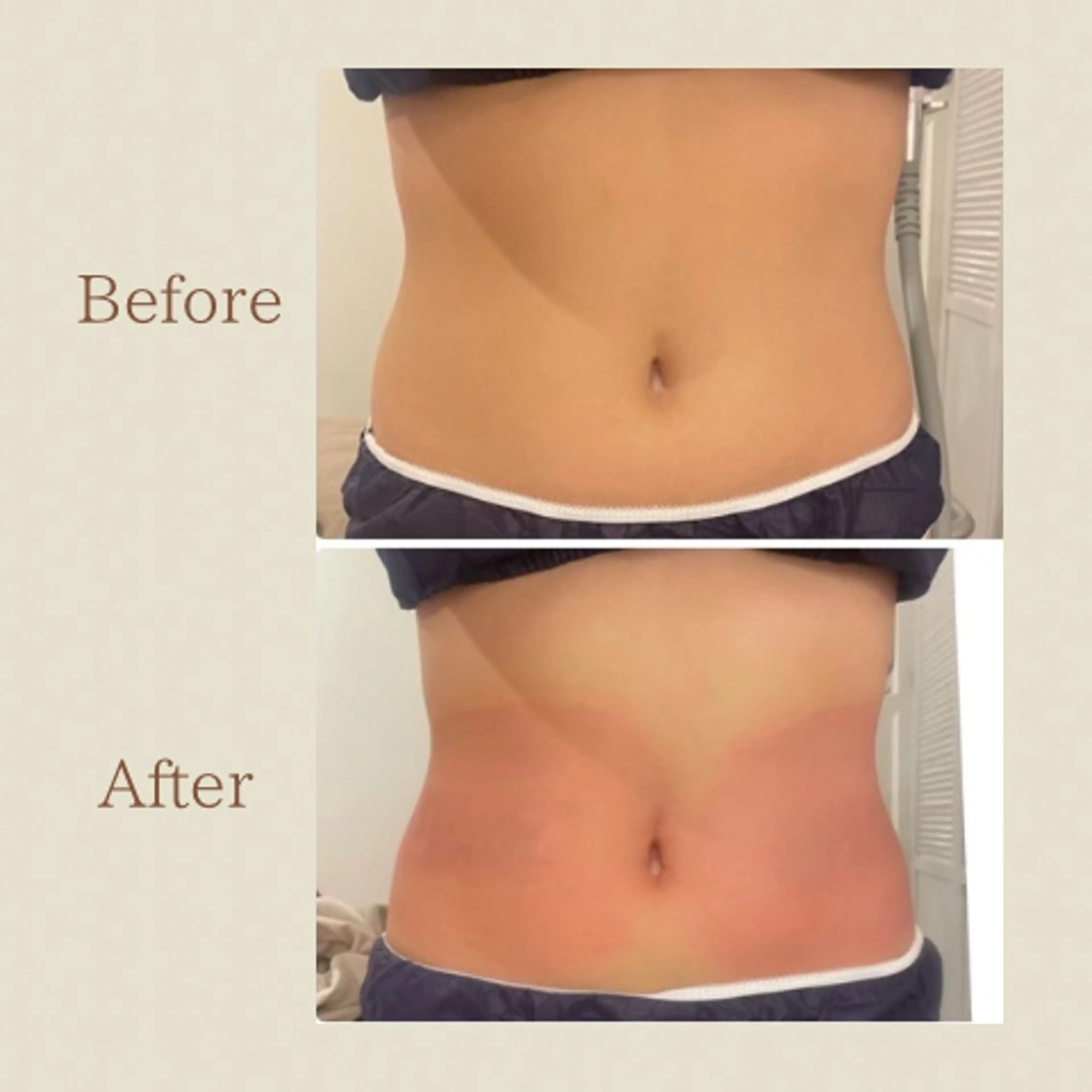 お腹痩せエステ Flat BELLY 恵比寿所属・【腸もみ/冷却痩身】 お腹エステ/恵比寿のエステ・リラクイメージ