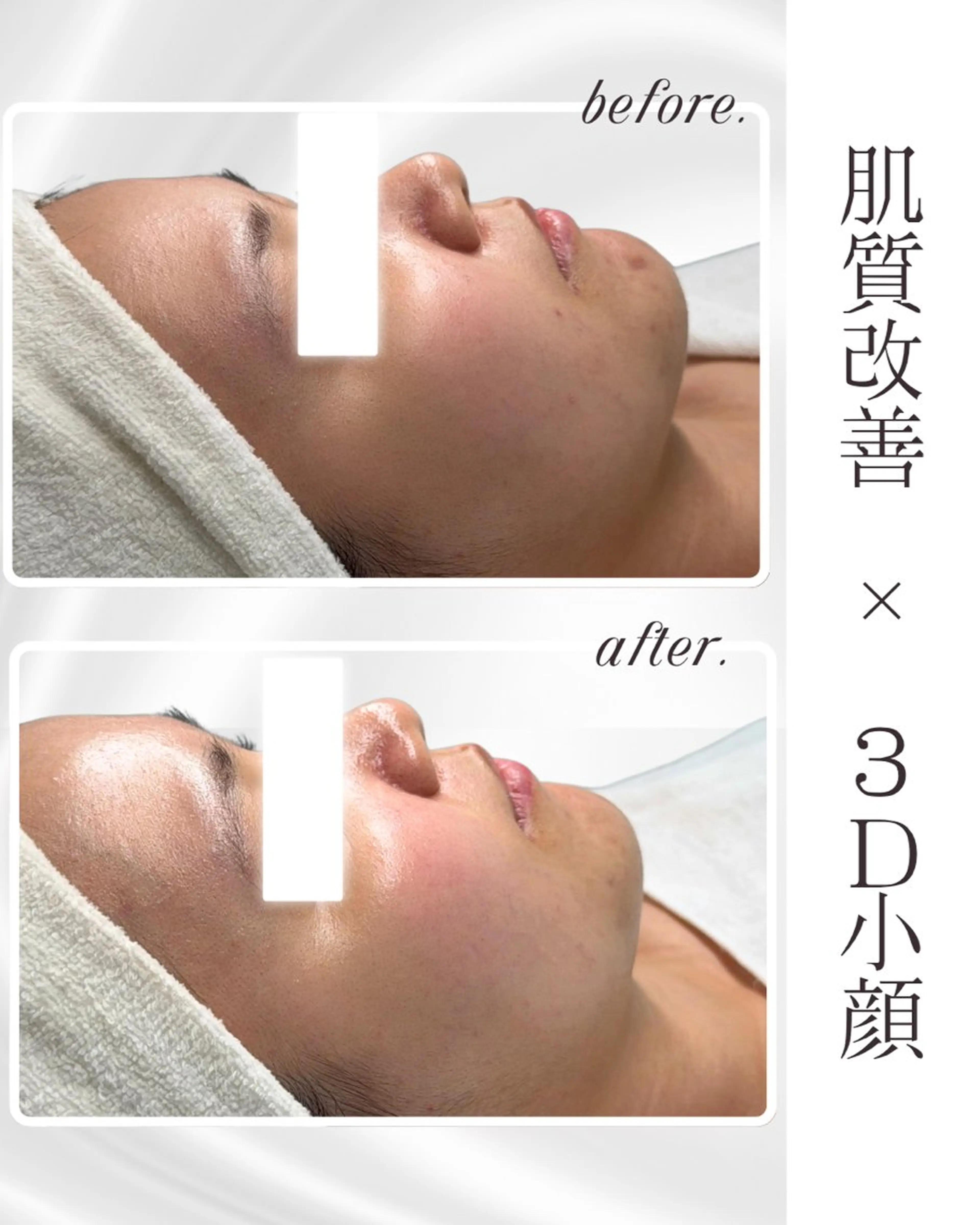 Liam《美肌管理/ 3D小顔/脂肪ケア》のその他イメージ