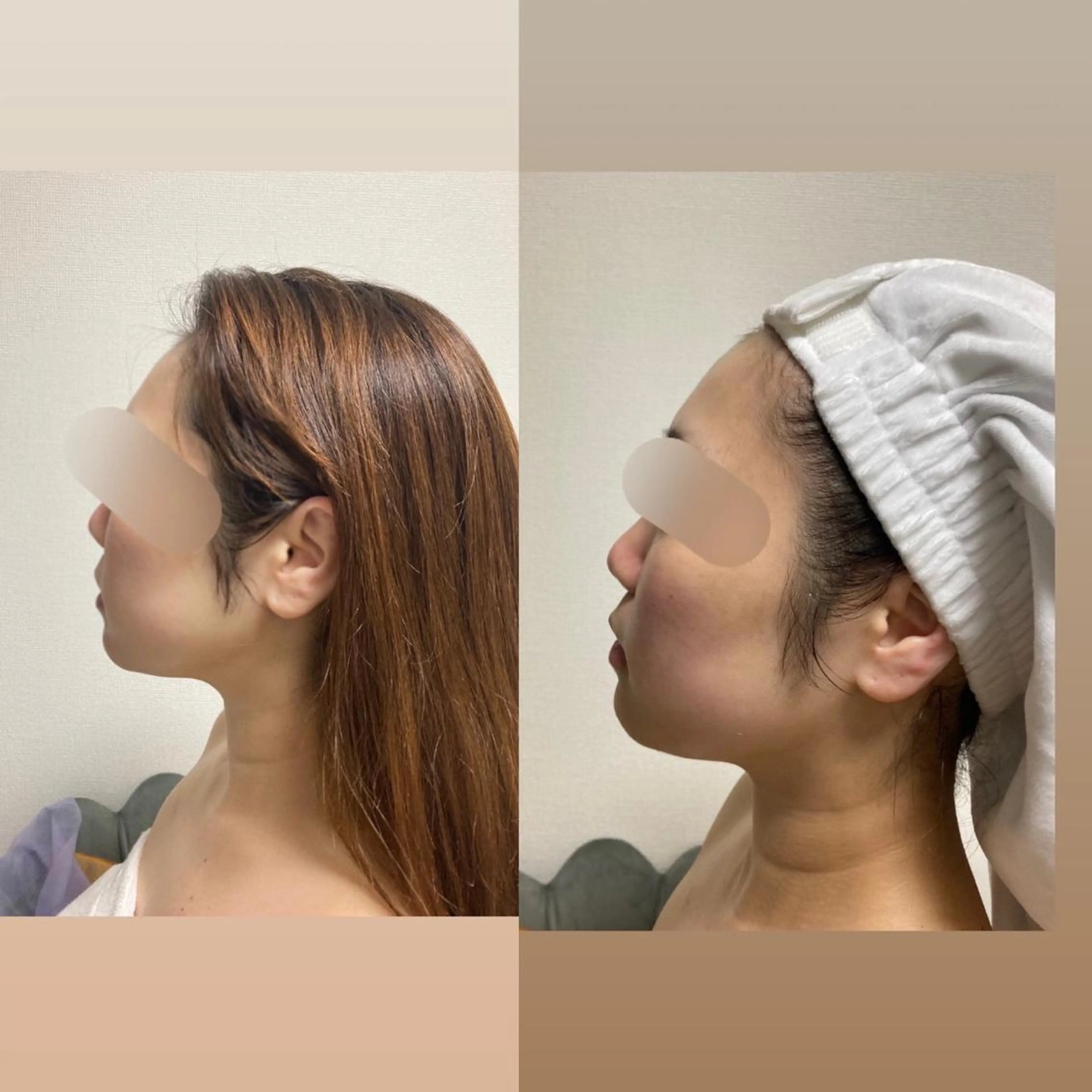 カラー パーマ ヘアアレンジ メンズ キッズ ネイル マツエク・マツパ アイブロウ 毛穴，ニキビ跡 改善総合サロンのその他イメージ
