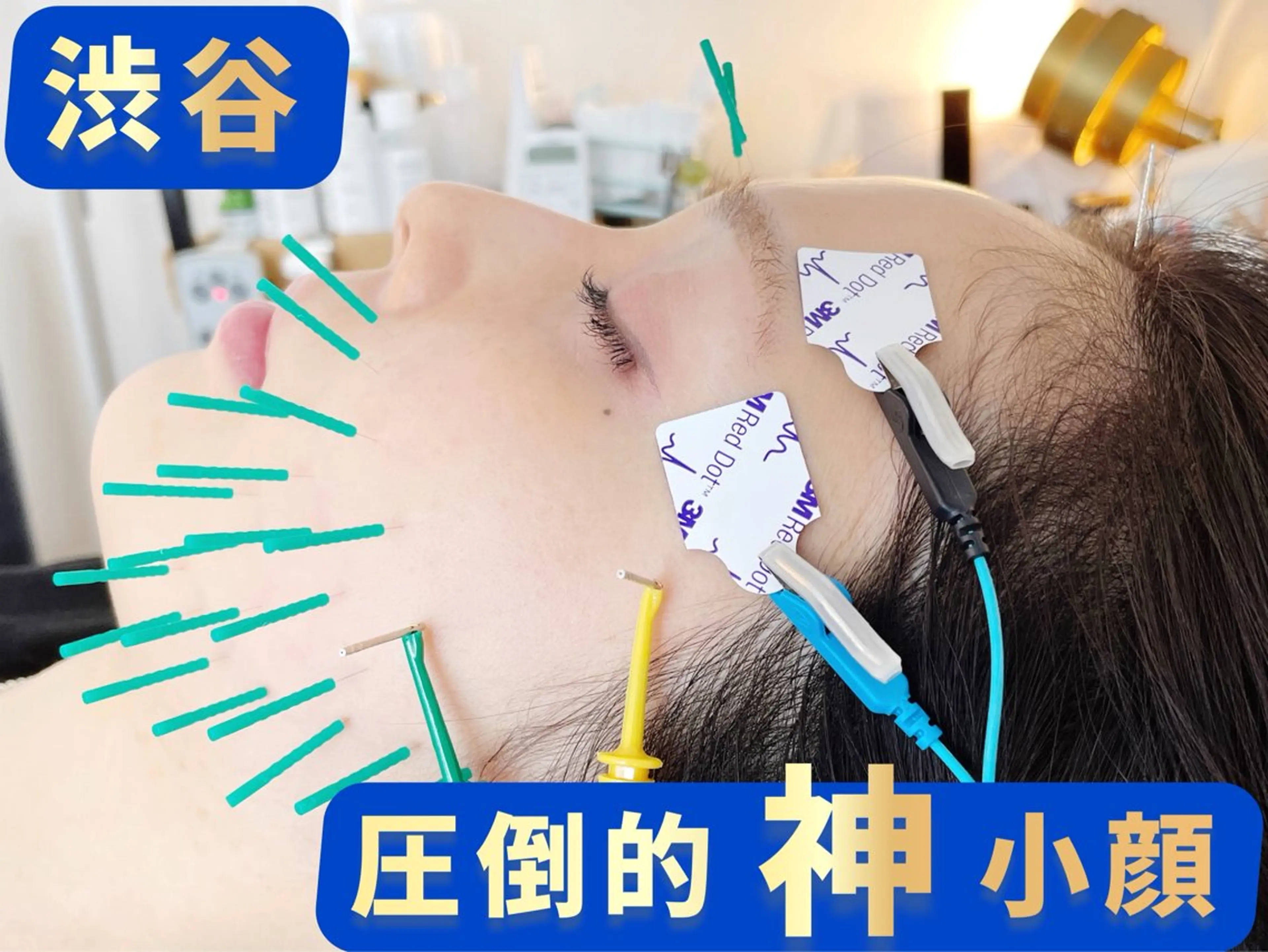 エステ リラク 小顔美容鍼専門サロン 渋谷YZのエステ・リラクイメージ