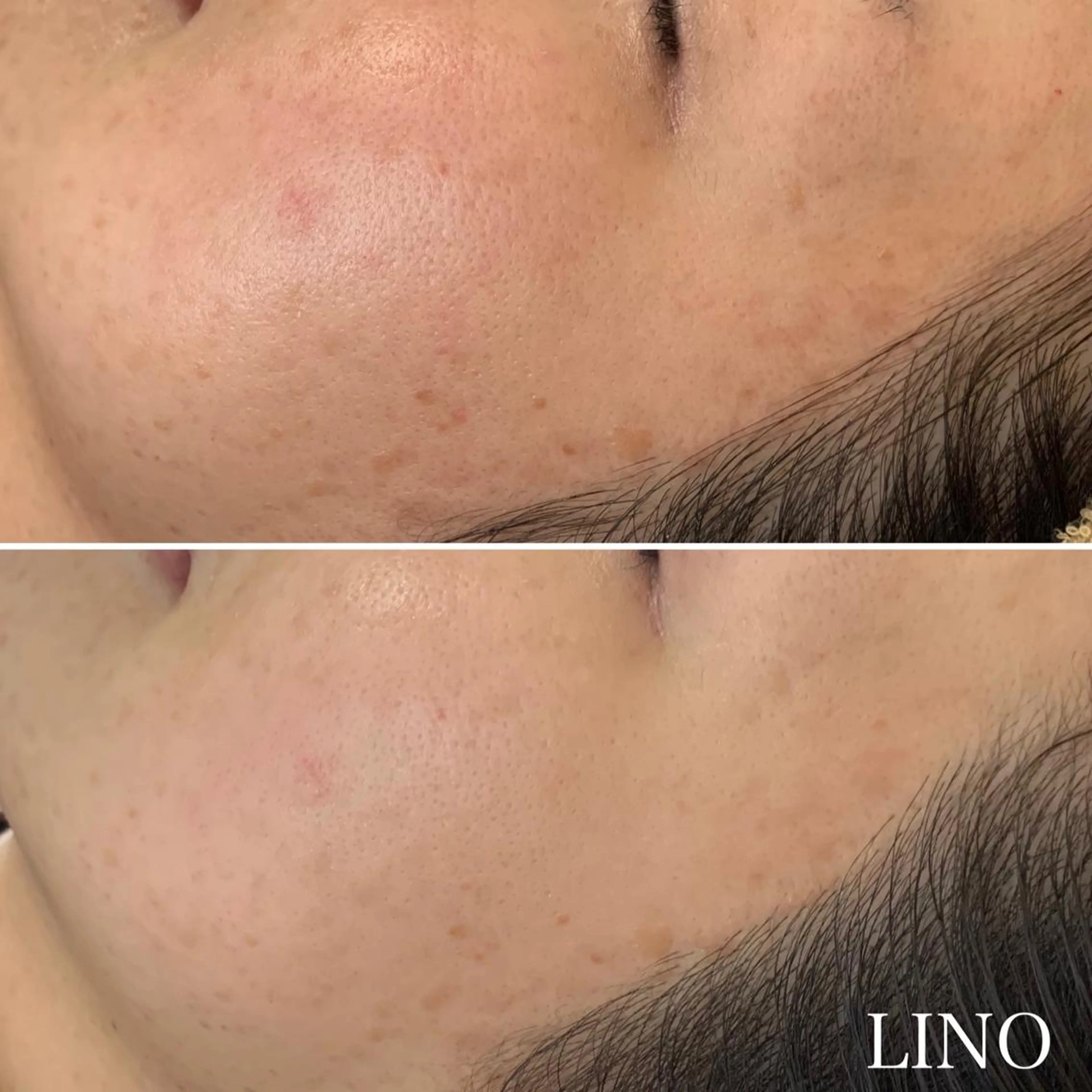 beautysalon  LINO所属・7月限定【平日限定】 全メニュ¥4,400のエステ・リラクイメージ