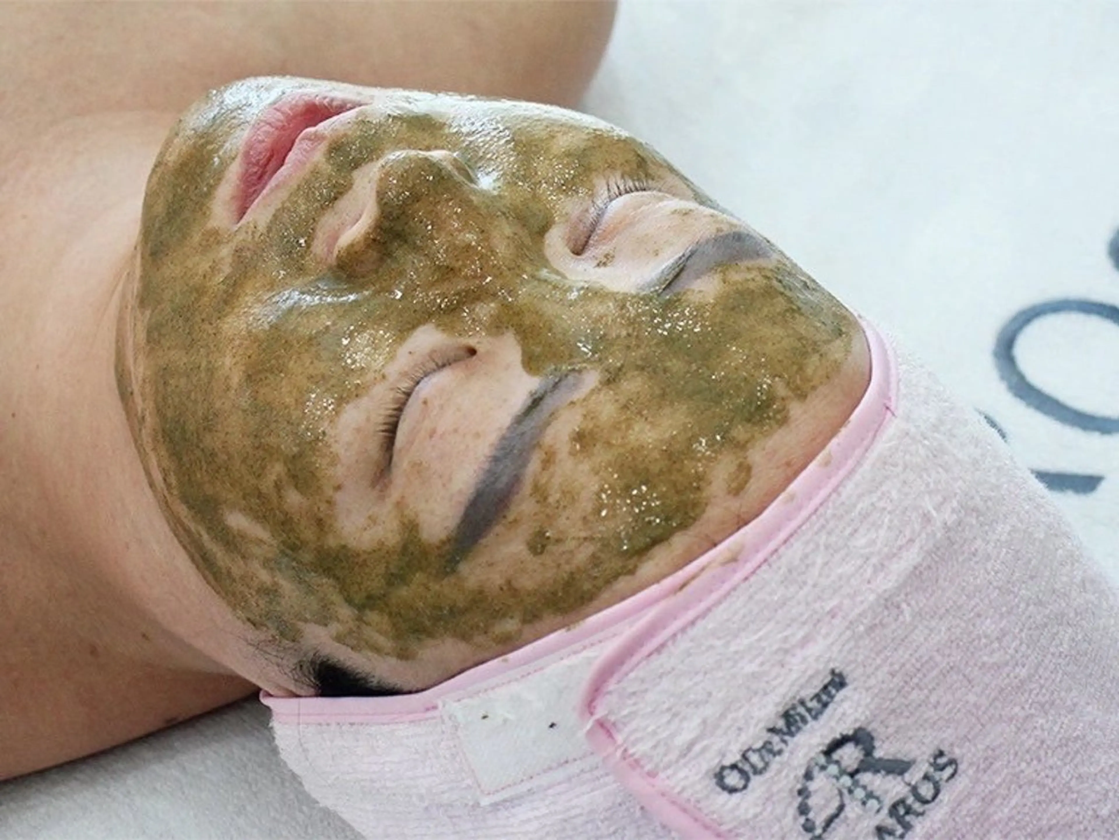 お試し◆ハーブピーリング人気No2◆韓国発のアマロス♪ニキビケアx剥離なしの写真