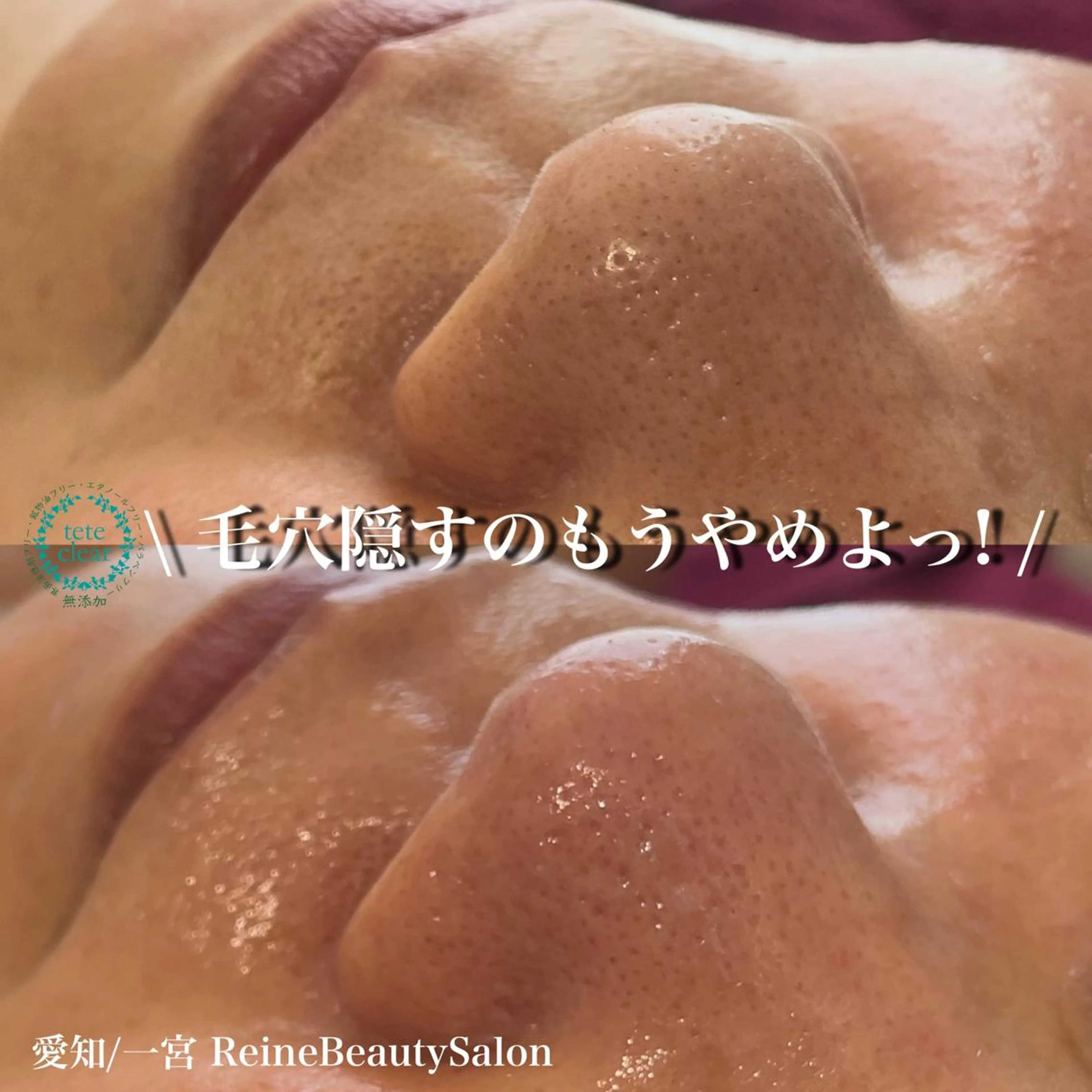 エステ Reine BeautySalon所属・毛穴/シミ肝斑/脱毛 横山梨里のエステ・リラクイメージ