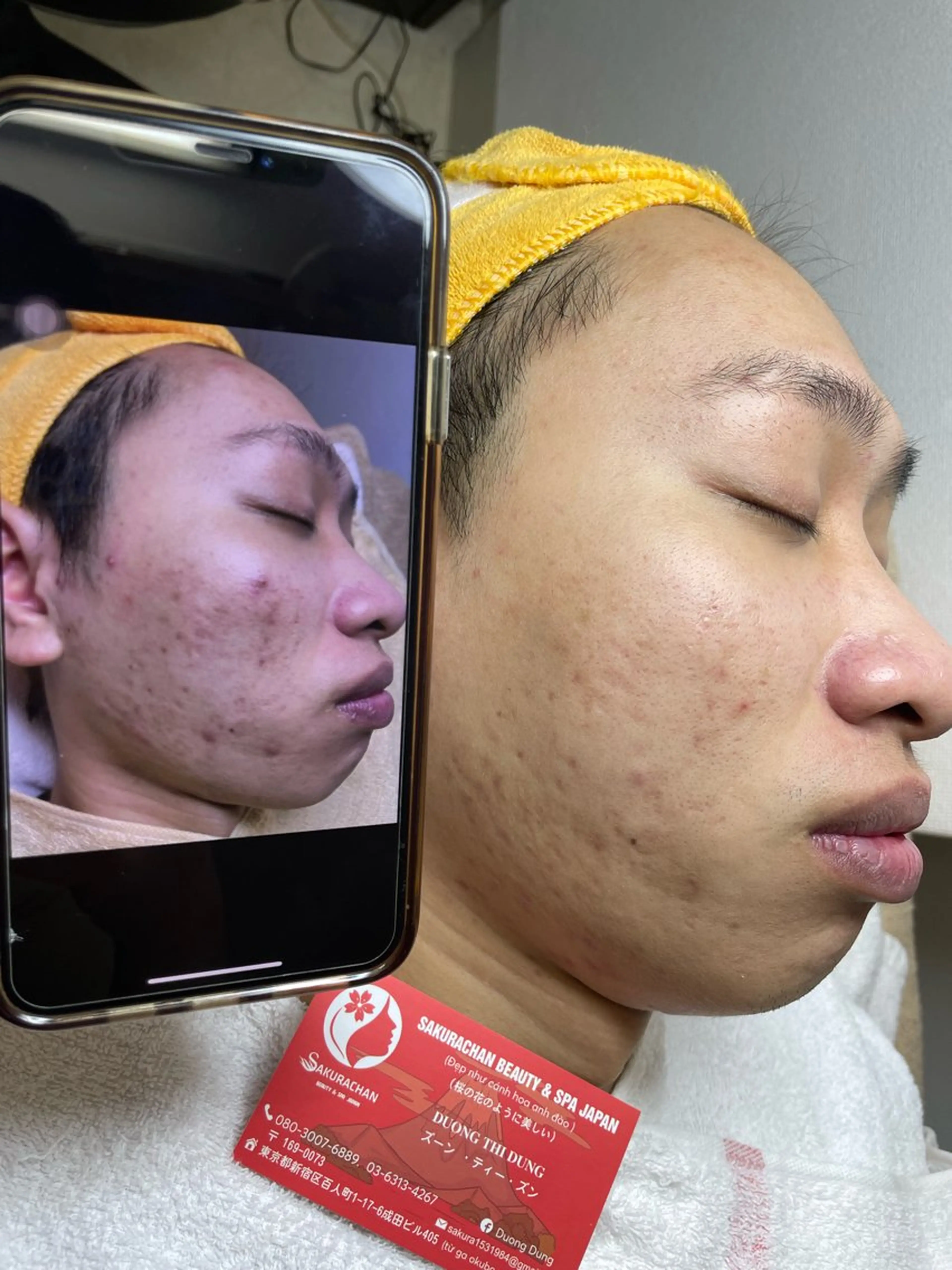 ニキビ、痩身、脱毛、 サクラチャンスパのエステ・リラクイメージ