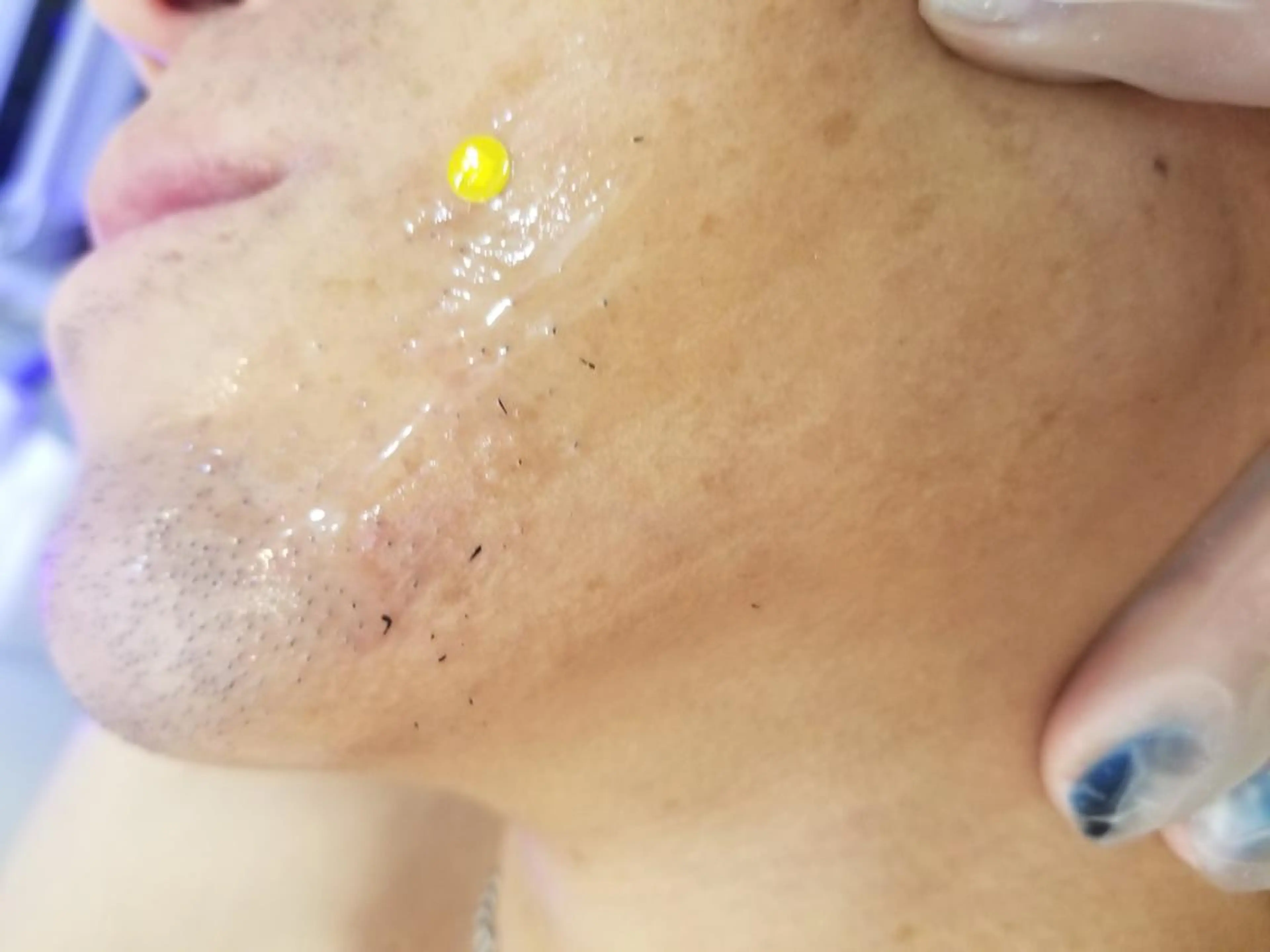 メンズ 脱毛 salonde ReGodのエステ・リラクイメージ