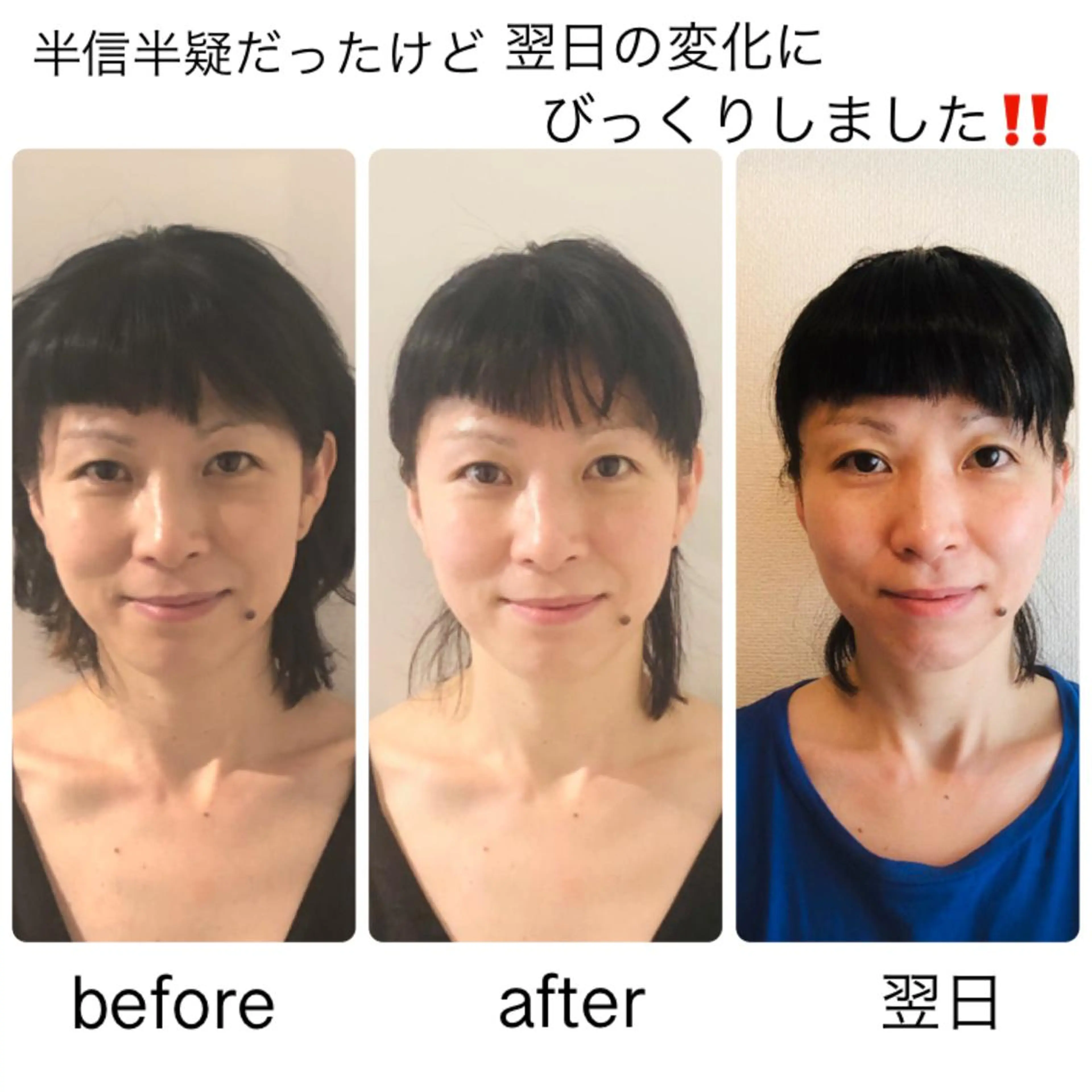 ミディアム 小顔矯正専門サロンジュマリ所属・町田 淳子のエステ・リラクイメージ