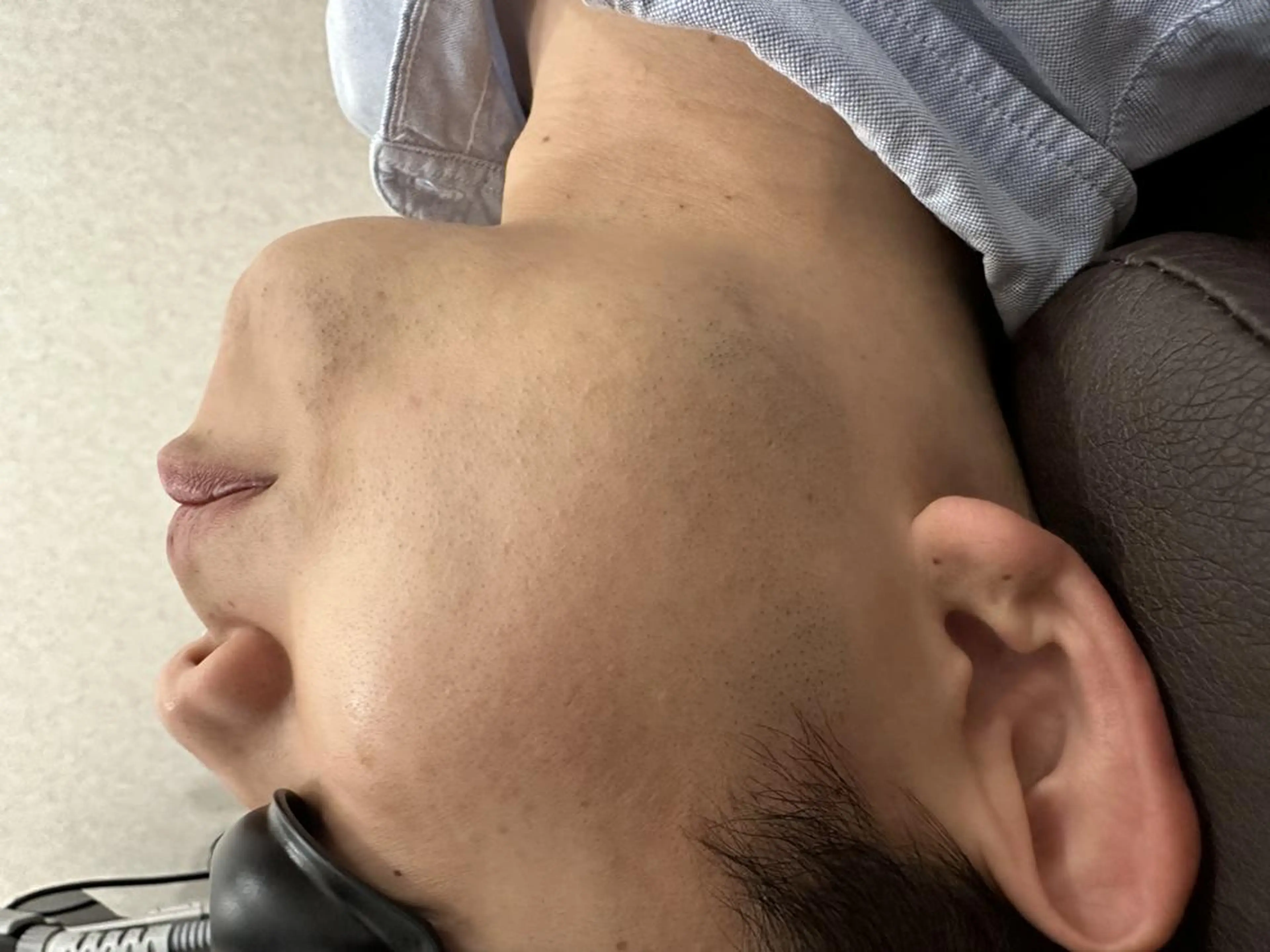 脱毛 20代から始める脱毛 salonLEPIAのエステ・リラクイメージ