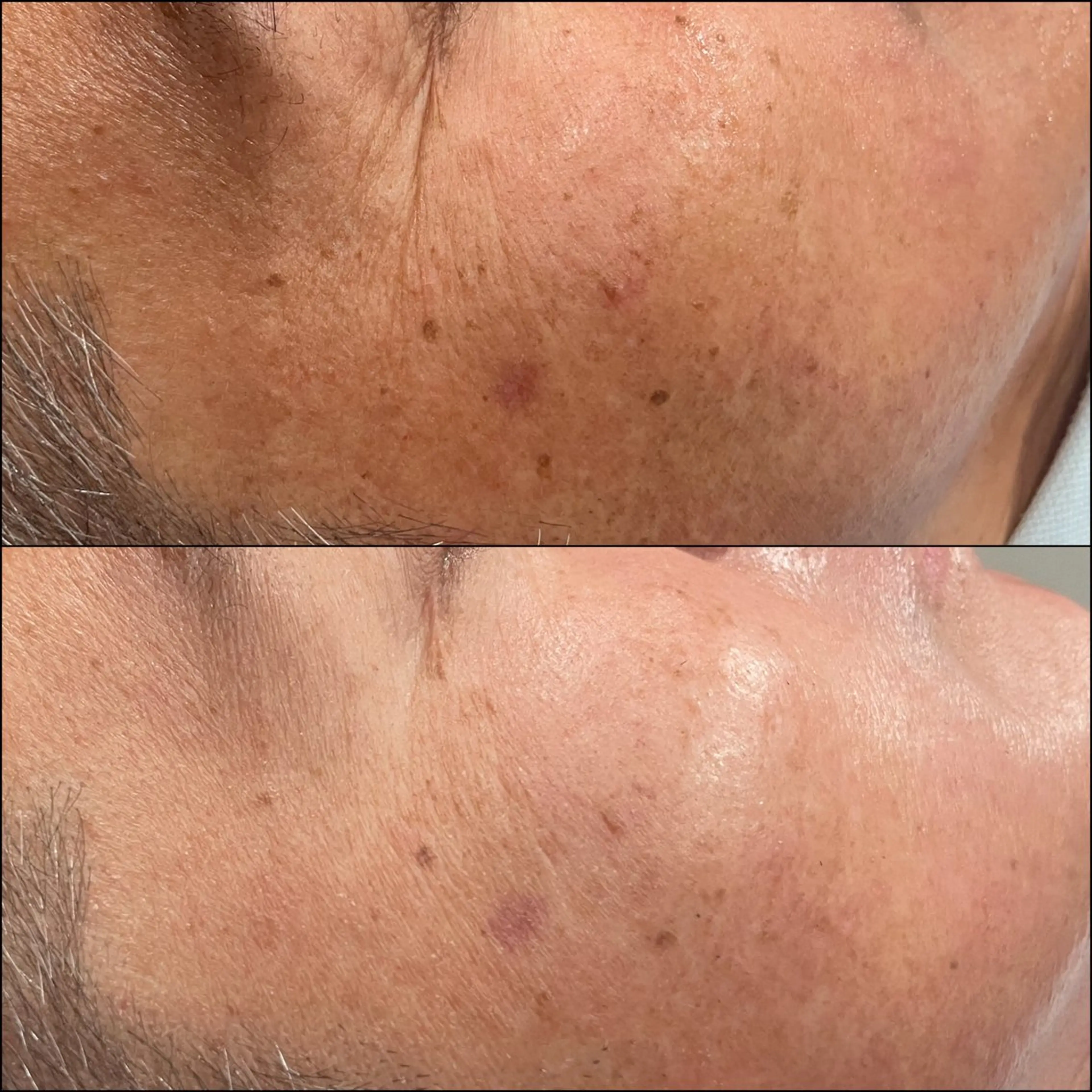 エステ LiZA エステティックサロンのエステ・リラクイメージ