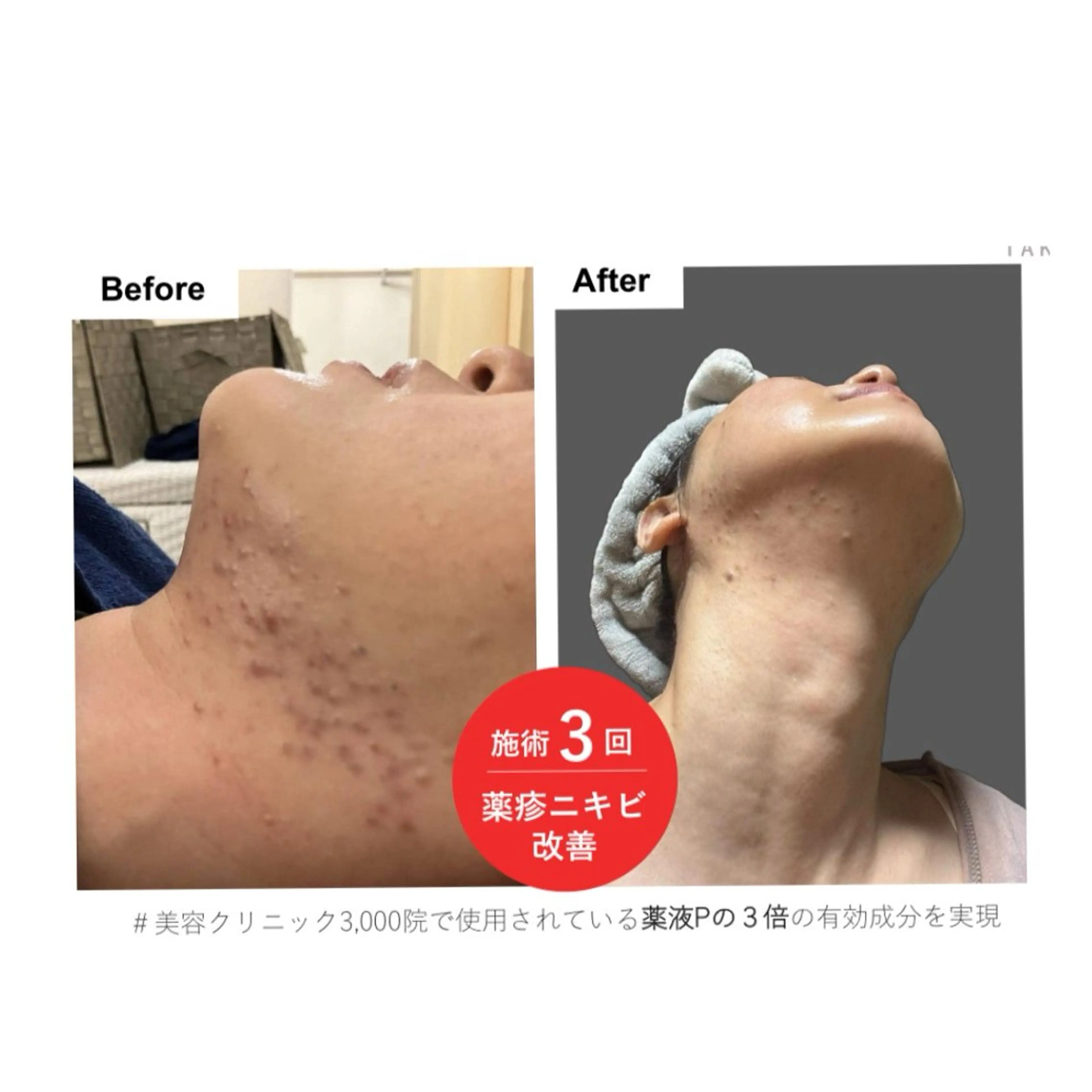 その他 akua...痩身・ 脱毛・ホワイトニングのその他イメージ