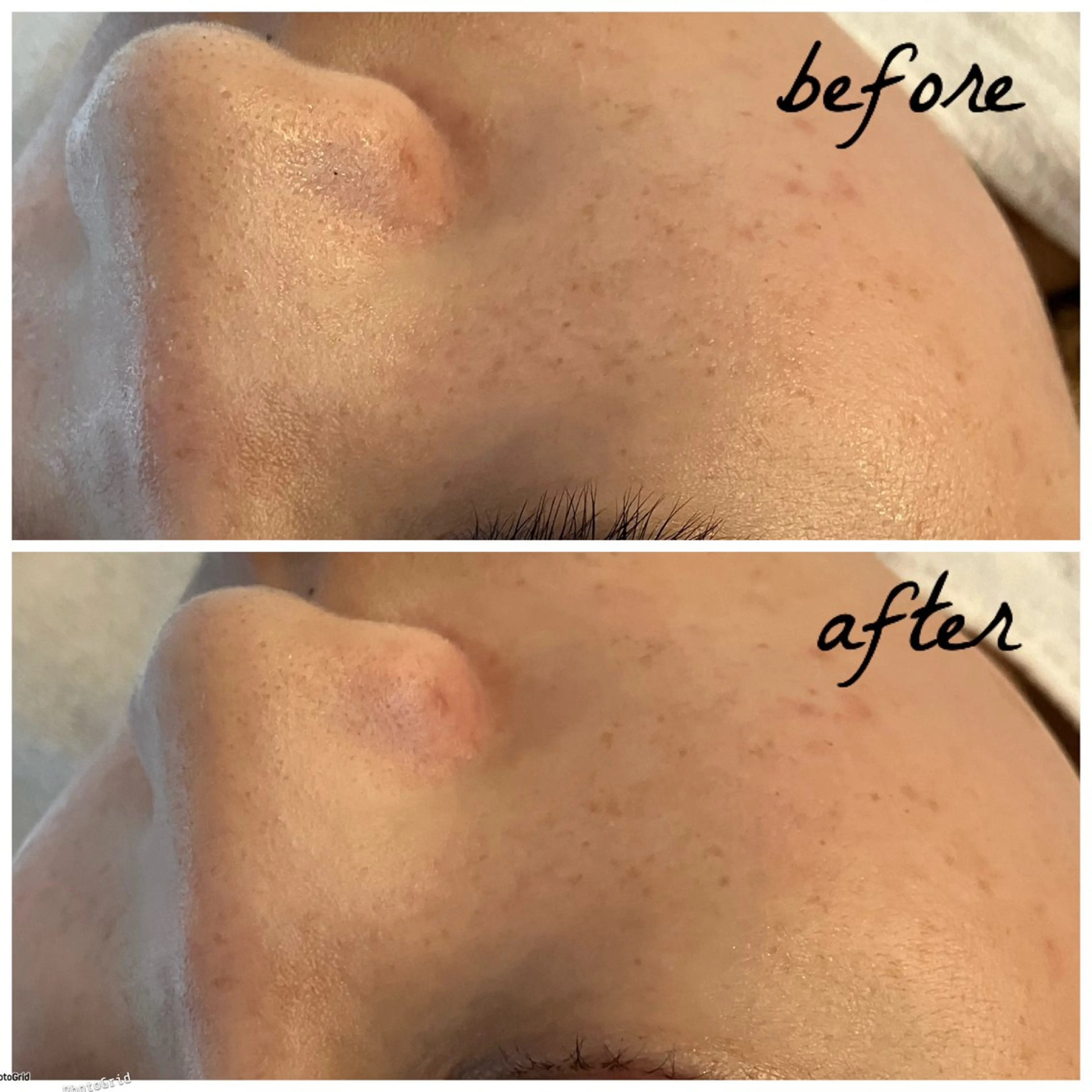 メンズ エステ メナード岐阜茜部 杉浦のエステ・リラクイメージ