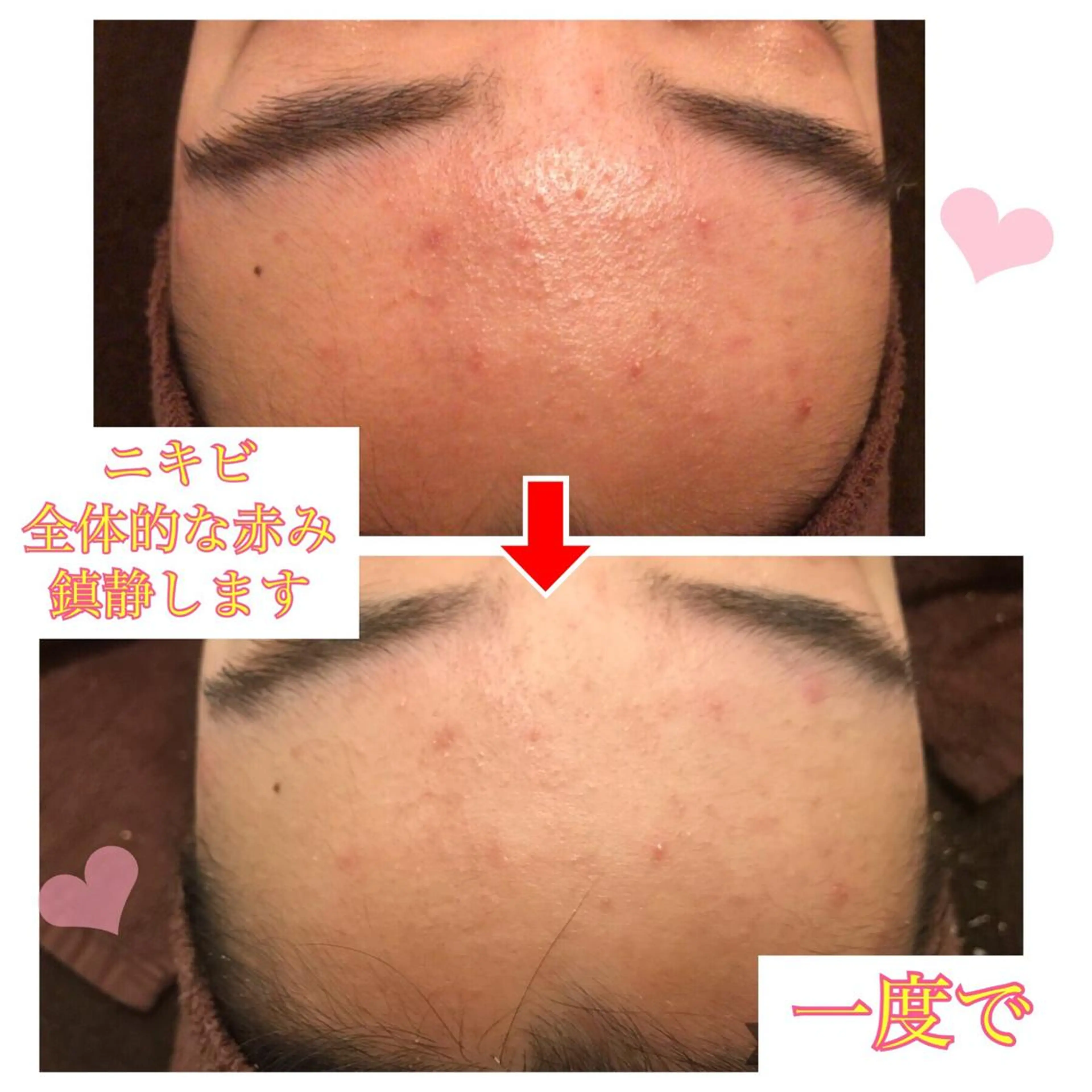 ミディアム カラー パーマ ヘアアレンジ メンズ キッズ ネイル マツエク・マツパ 四つ星サロン🎖 腸＆ニキビケアに特化のエステ・リラクイメージ