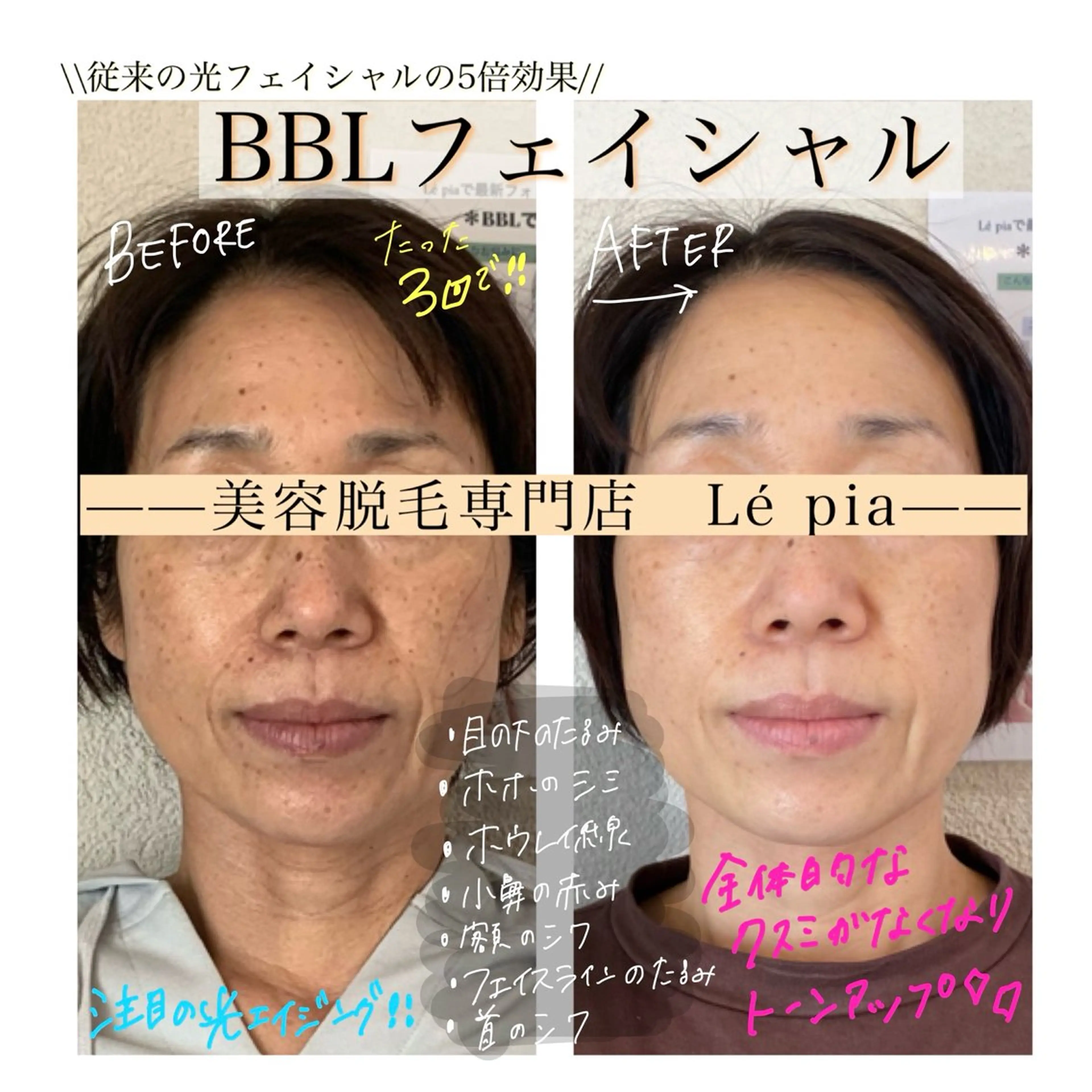 エステ 肌質管理専門店 Lé pia　AMIのエステ・リラクイメージ