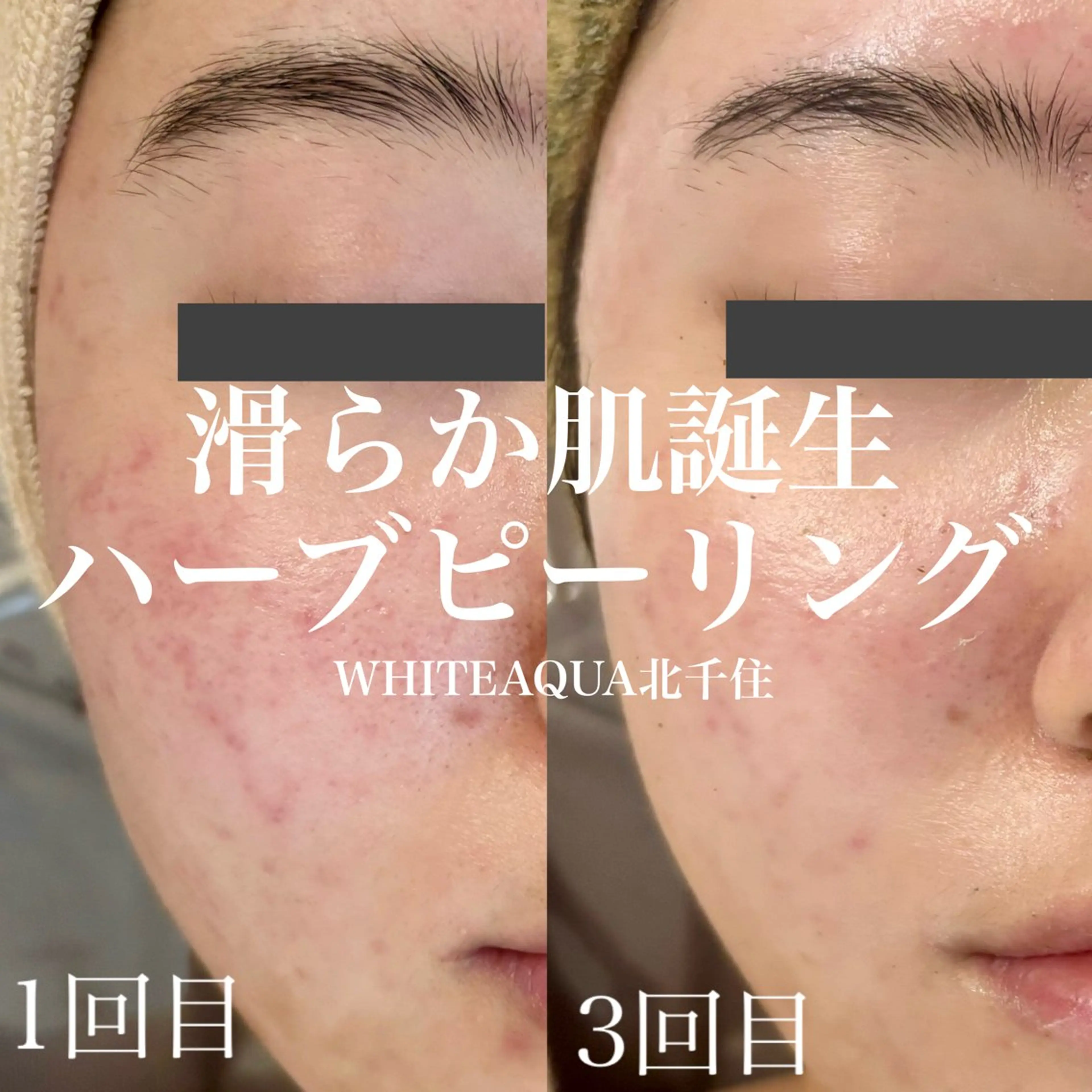 エステ WHITE AQUA 北千住店のエステ・リラクイメージ