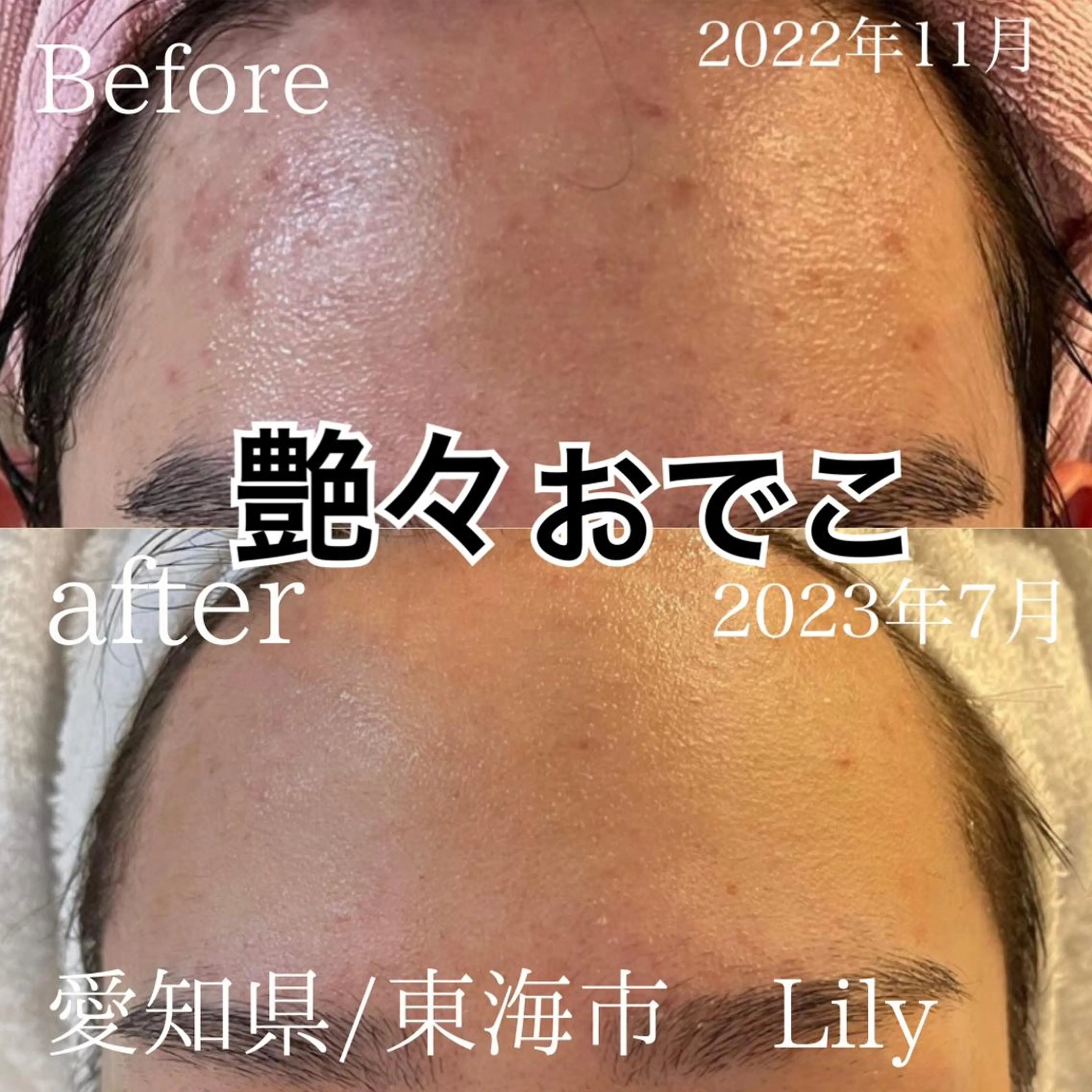 トータルビューティー サロンLilyのエステ・リラクイメージ