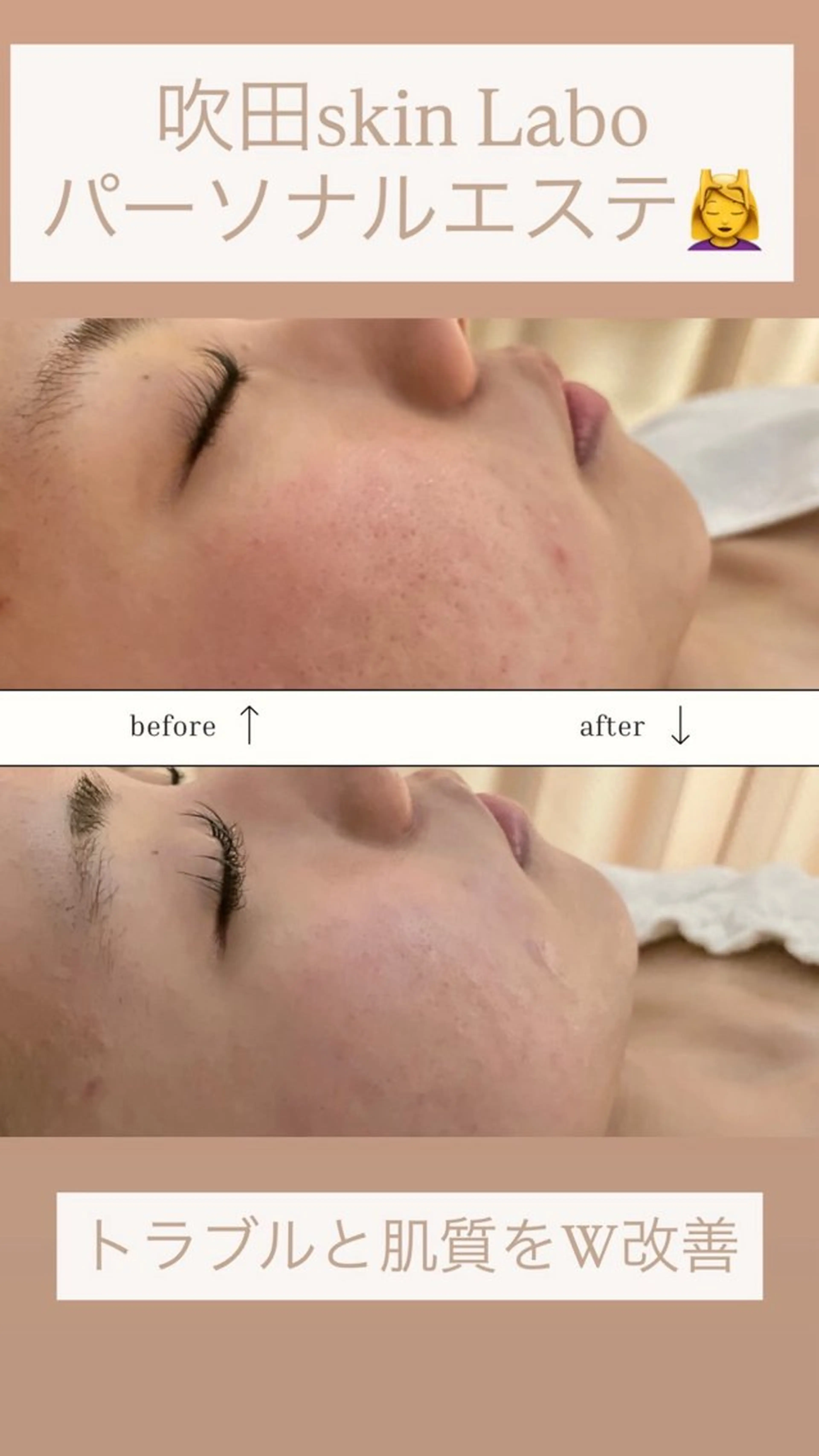 エステ skinLabo所属・saya Mのエステ・リラクイメージ