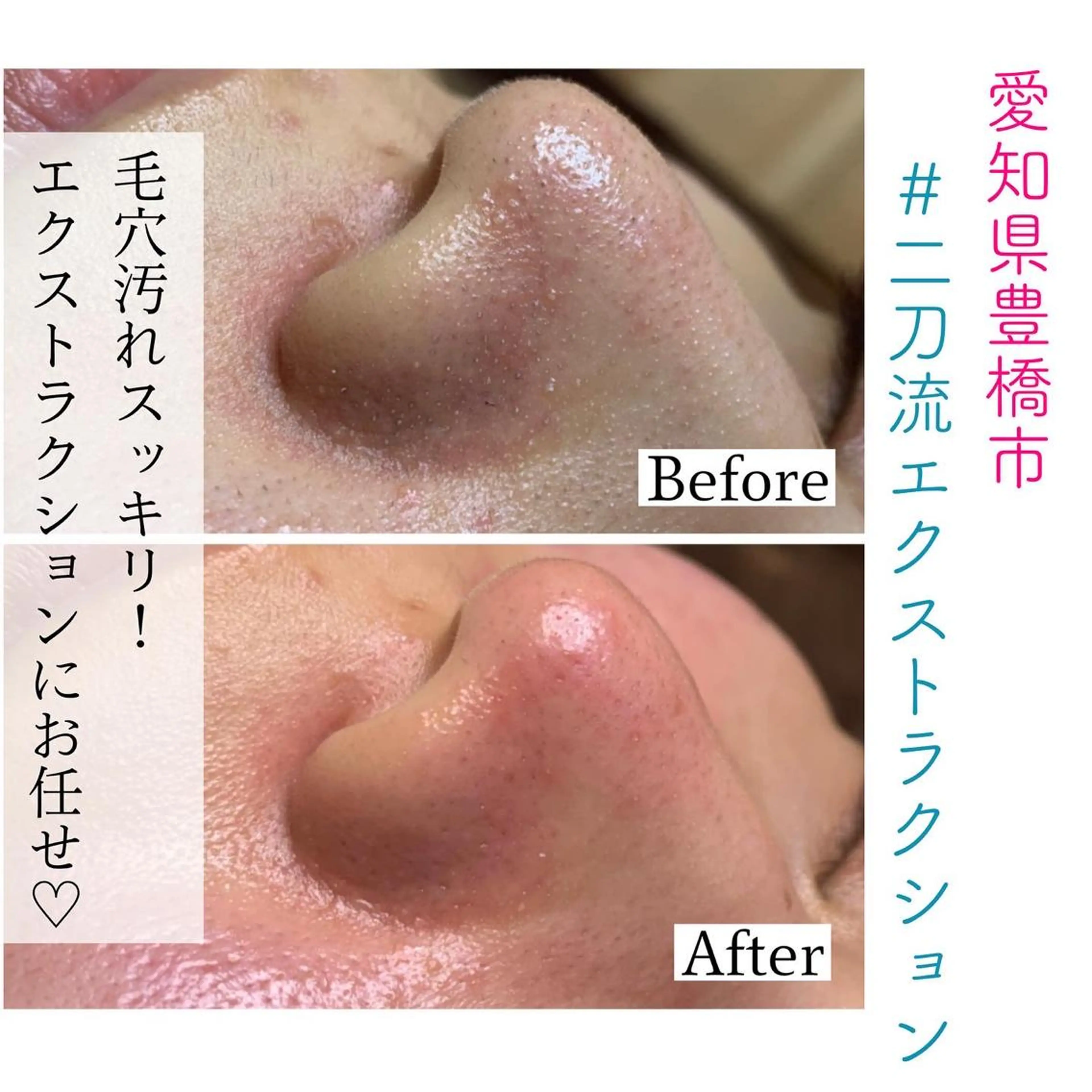 Organic&Detox salon Beloved所属・Beloved えなかのエステ・リラクイメージ
