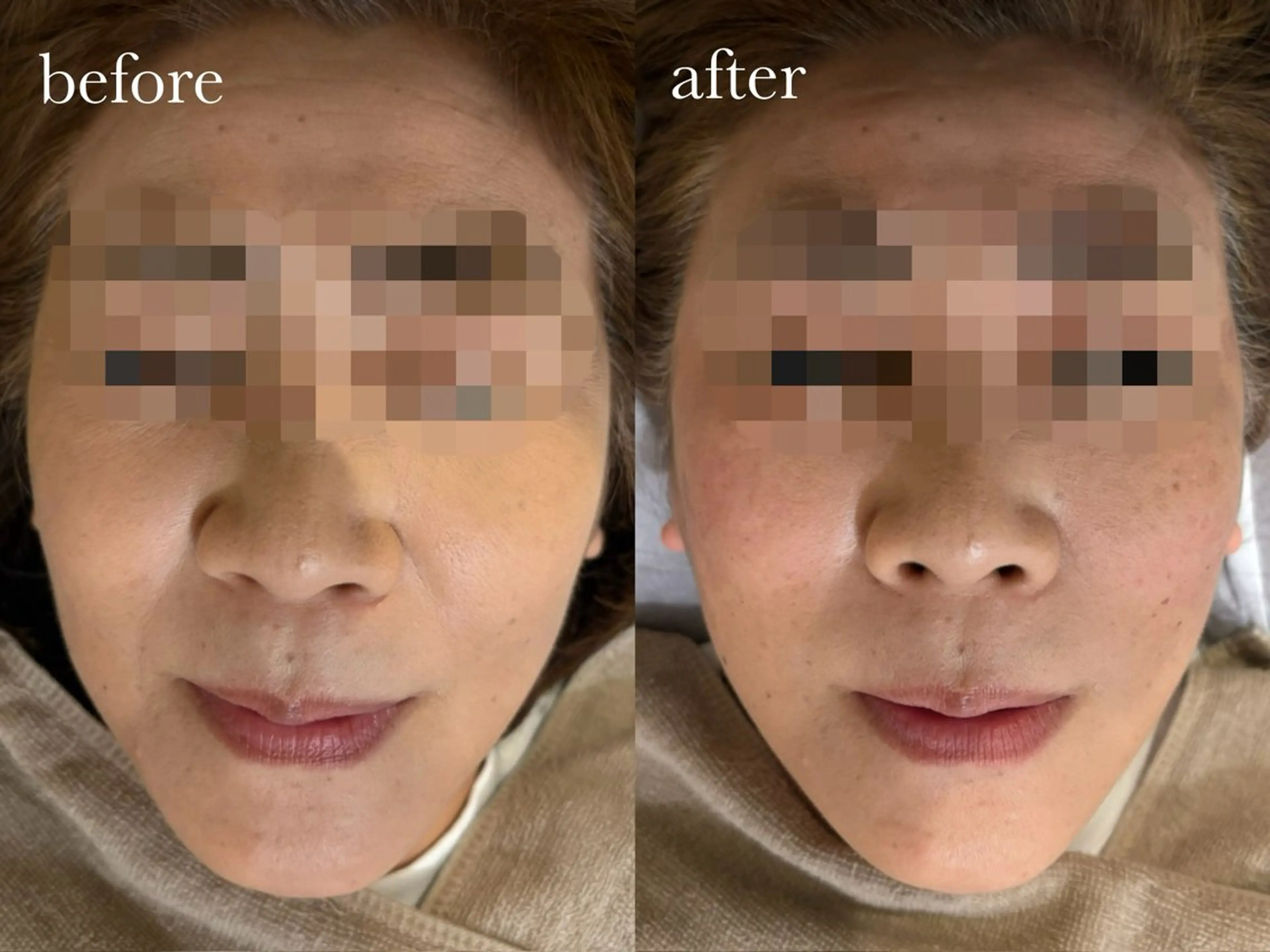 エステ リラク ENNE🦩小顔整体 師🌿 HINAKOのエステ・リラクイメージ