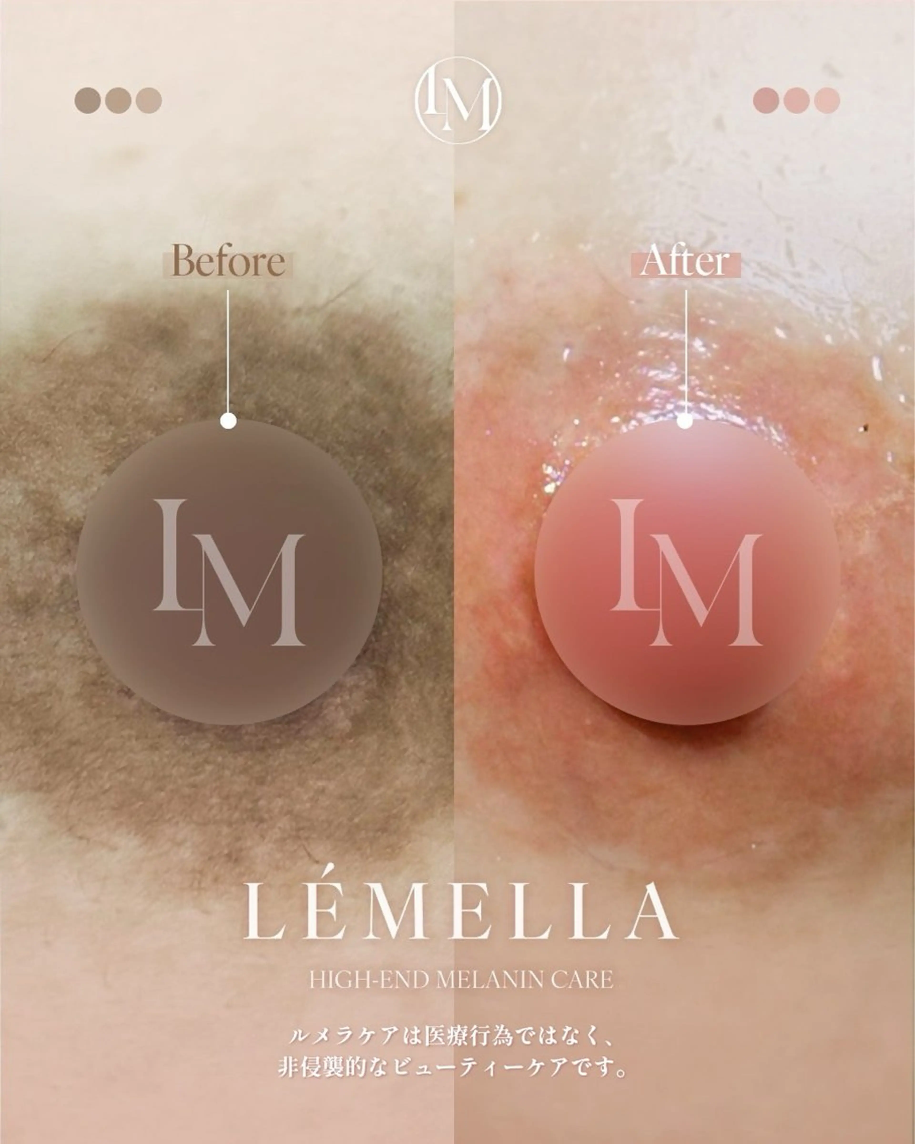 NAIL＆EYELASH SALON Lovers MOMO ～ラヴァーズ モモ～所属・Lovers MOMOのエステ・リラクイメージ