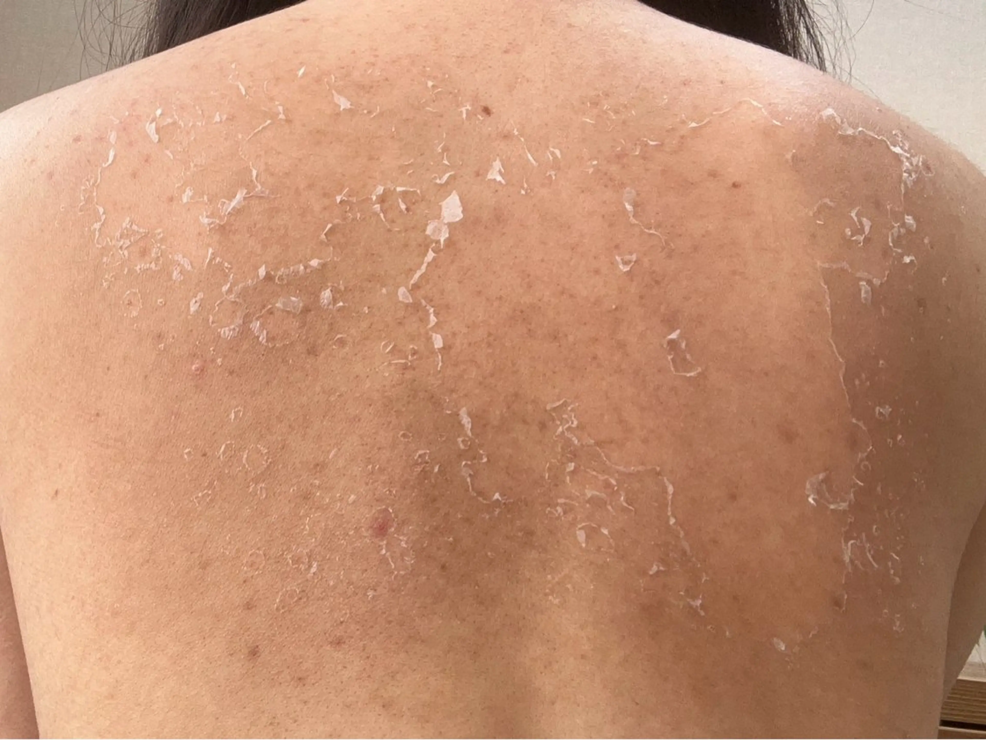 エステ clé skin 🌿ハーブピーリングのエステ・リラクイメージ