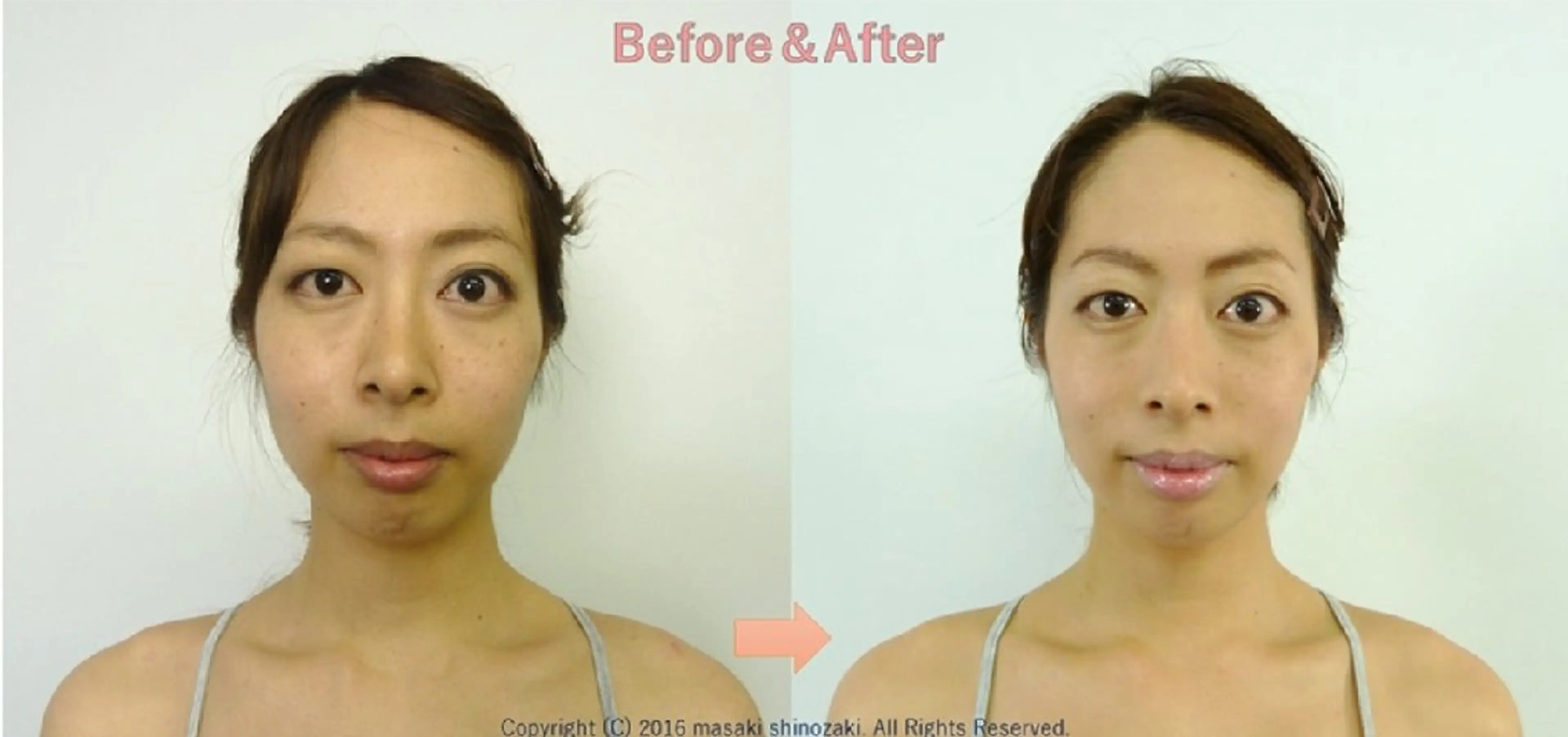 美容整サロン DOLCE のエステ・リラクイメージ