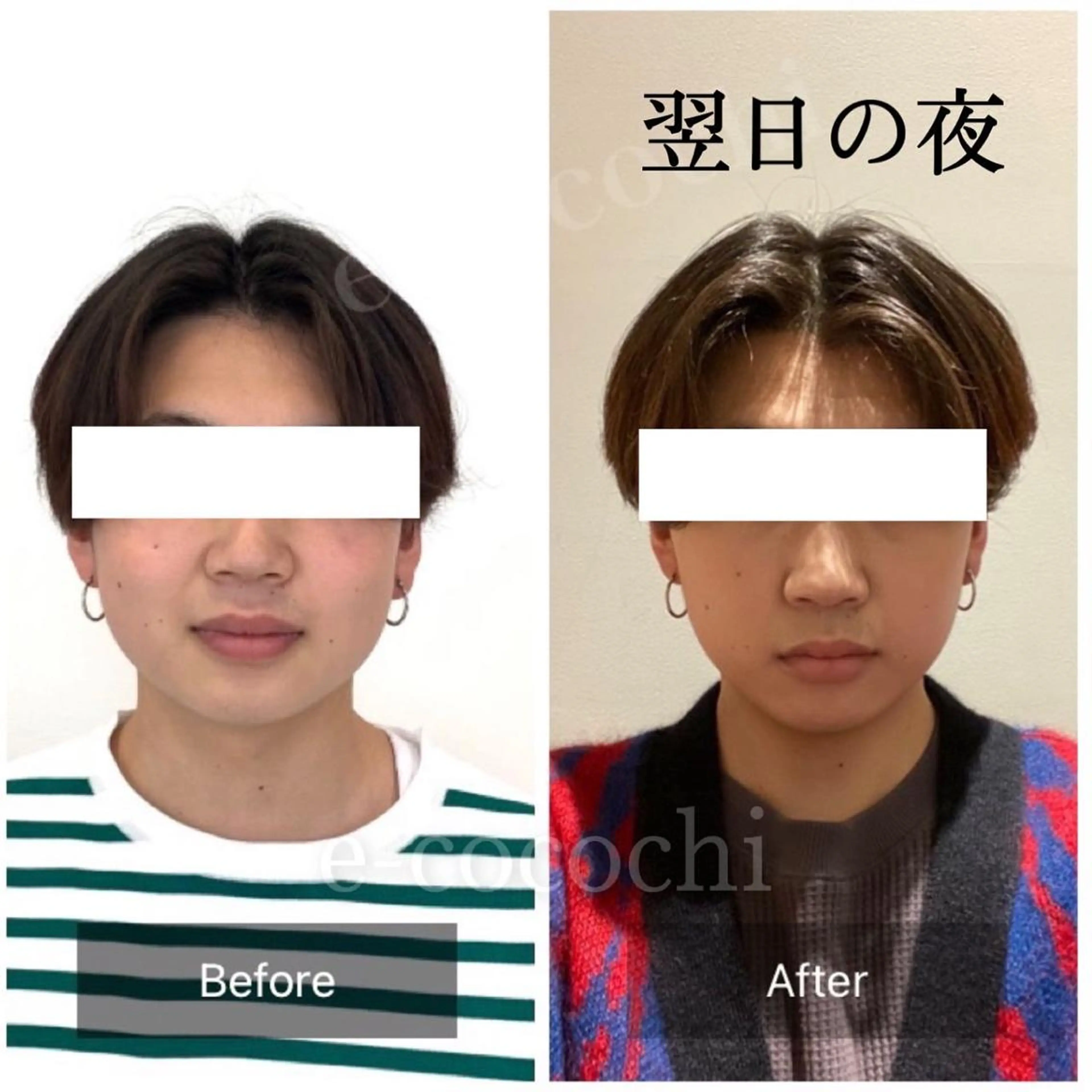 エステ リラク 小顔と ヘッドスパのお店のエステ・リラクイメージ