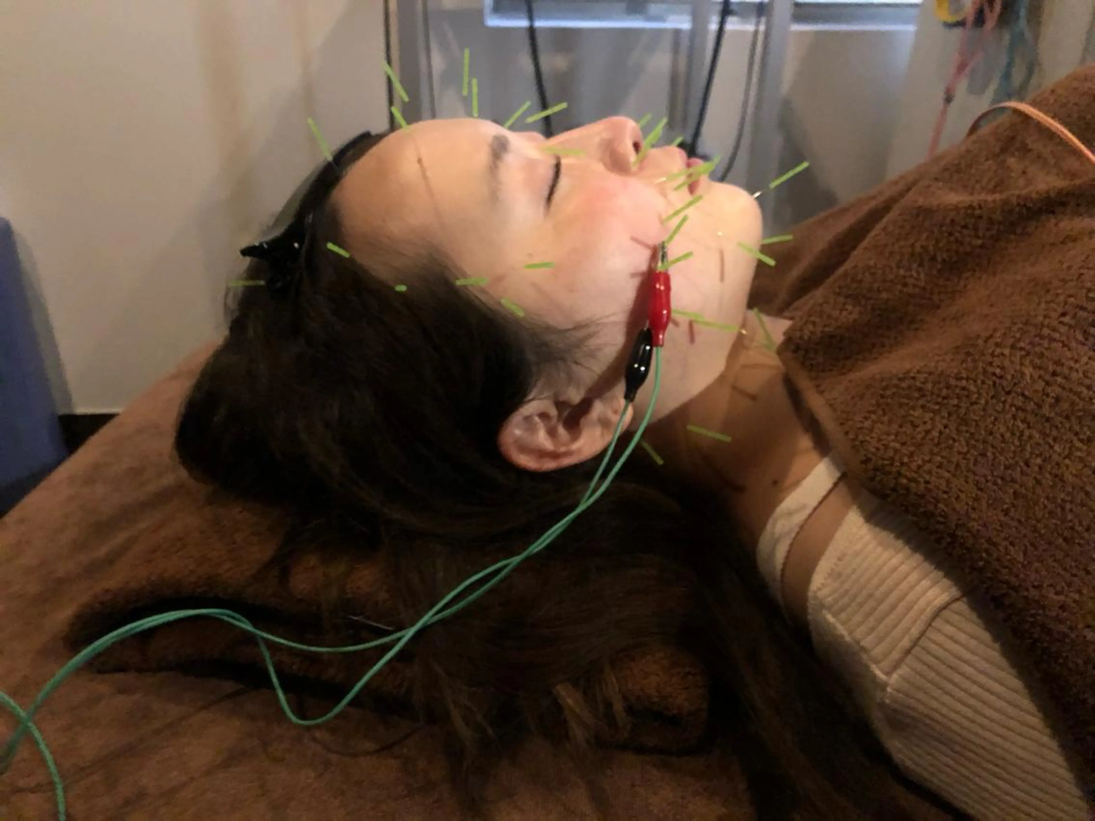 エステ リラク 美容鍼灸サロン LOMIHARIのエステ・リラクイメージ