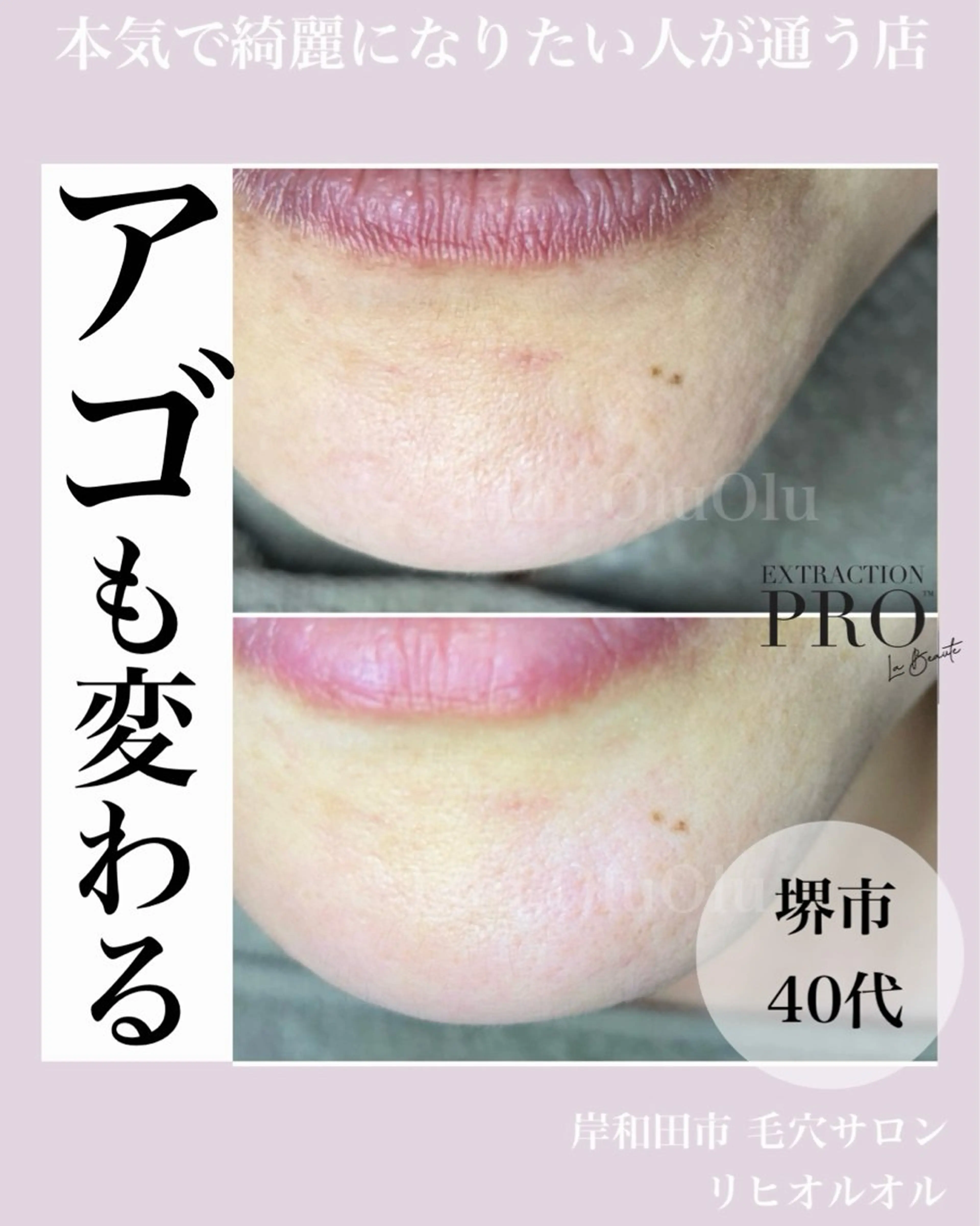 毛穴汚れ改善専門店/ 岸和田/リヒオルオルのエステ・リラクイメージ