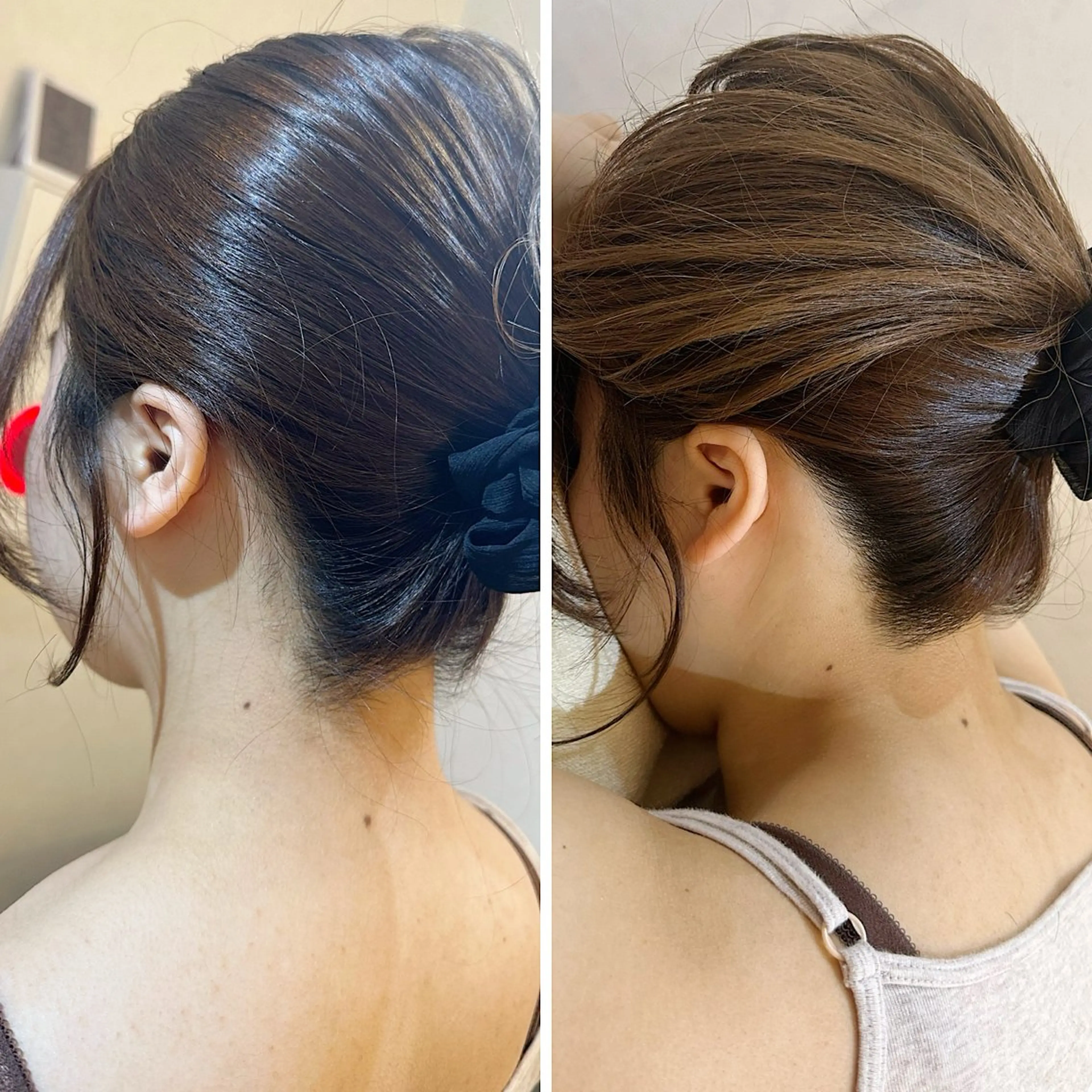 脱毛 うなじ脱毛/美肌脱毛 LABELのエステ・リラクイメージ