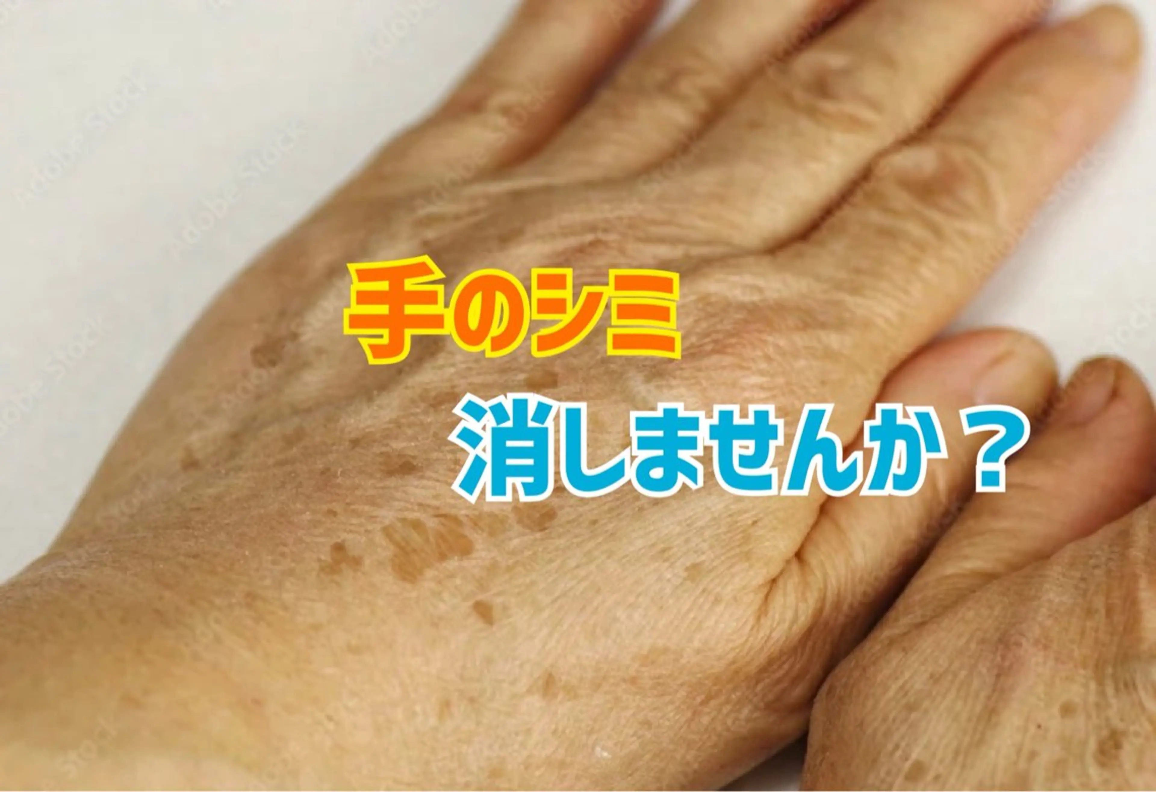 手の甲のシミ消し(光フォト)の写真