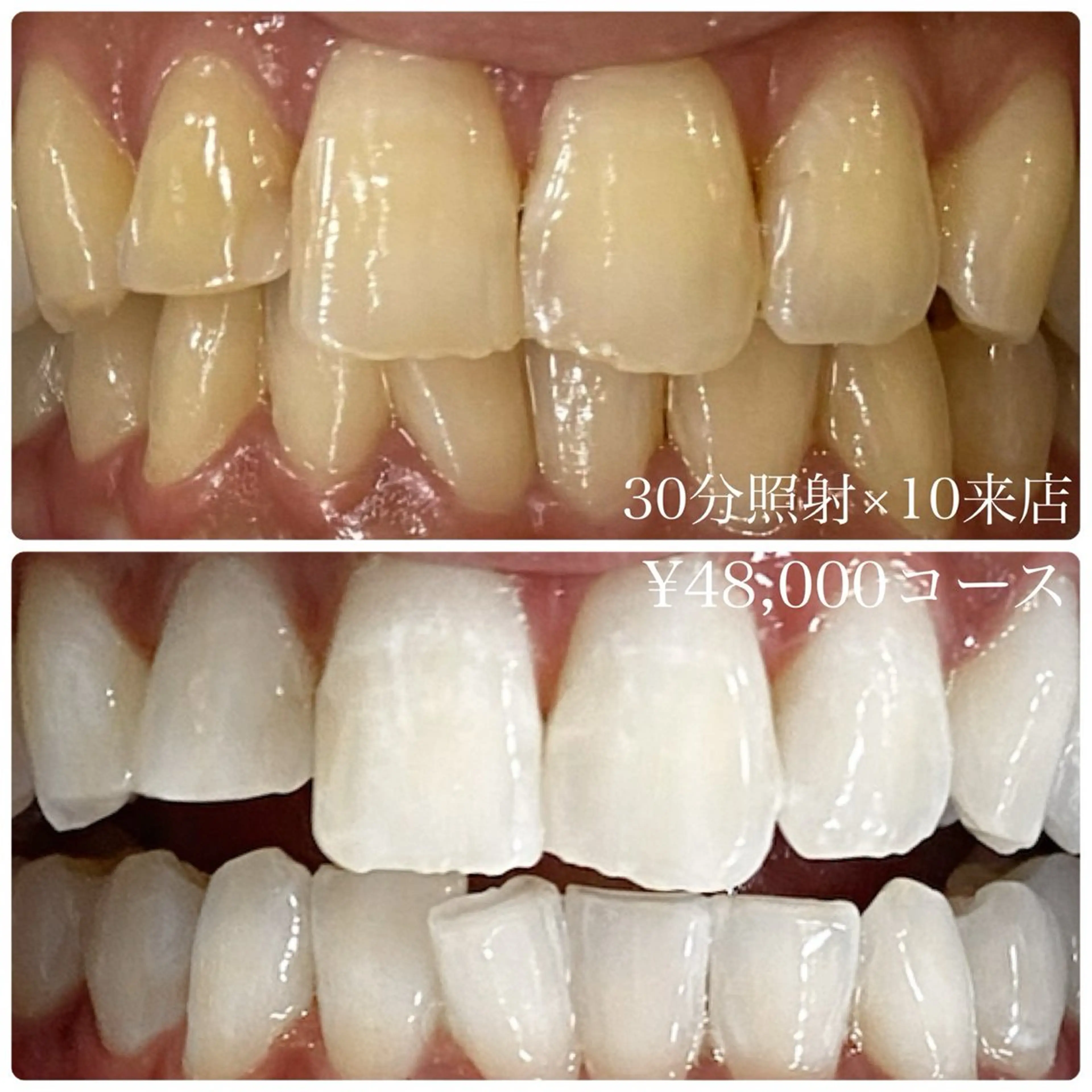 PLATINUM Beauty 横浜店所属・ホワイトニングルーム 横浜店のその他イメージ