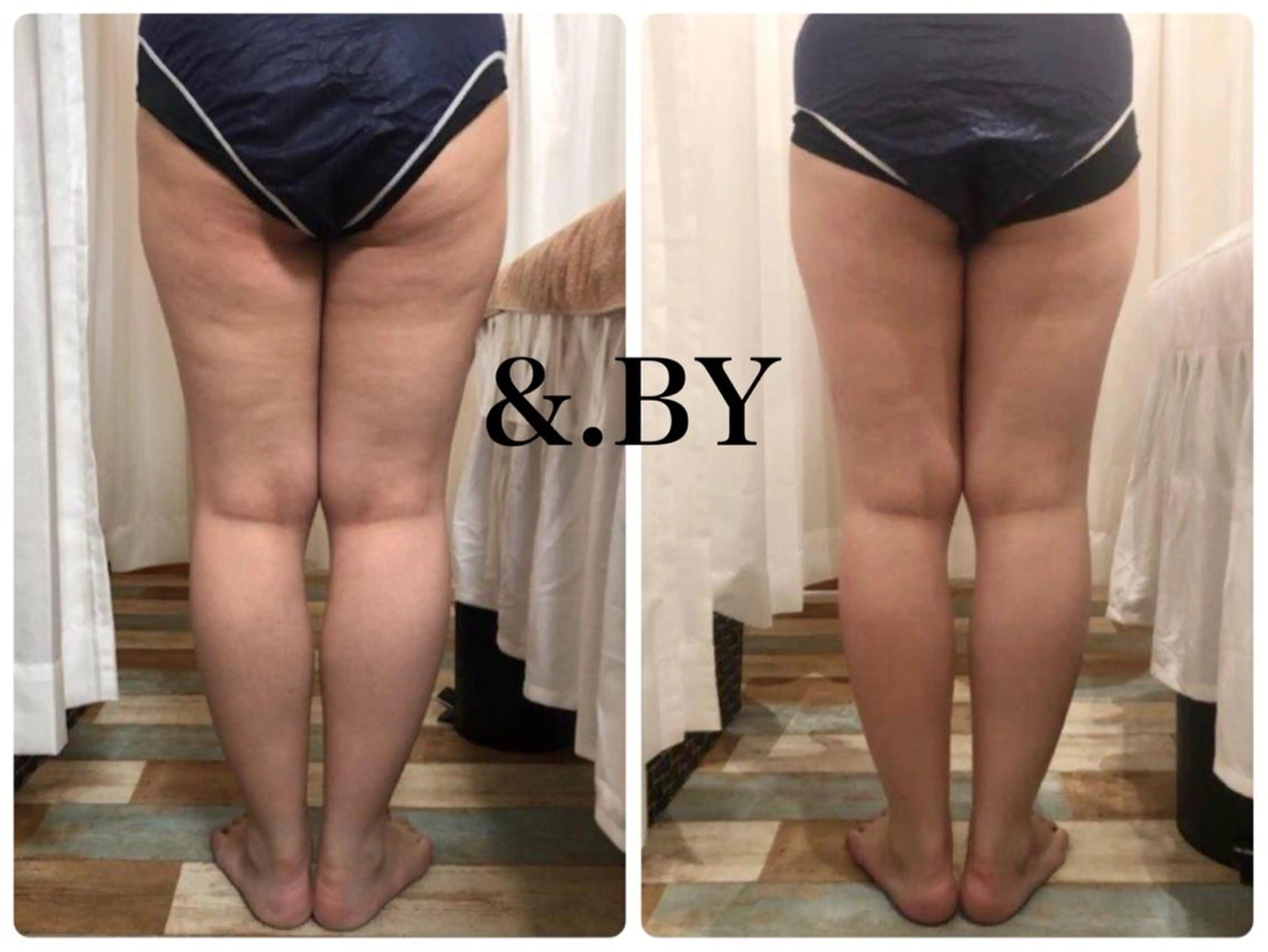 &. BYのエステ・リラクイメージ