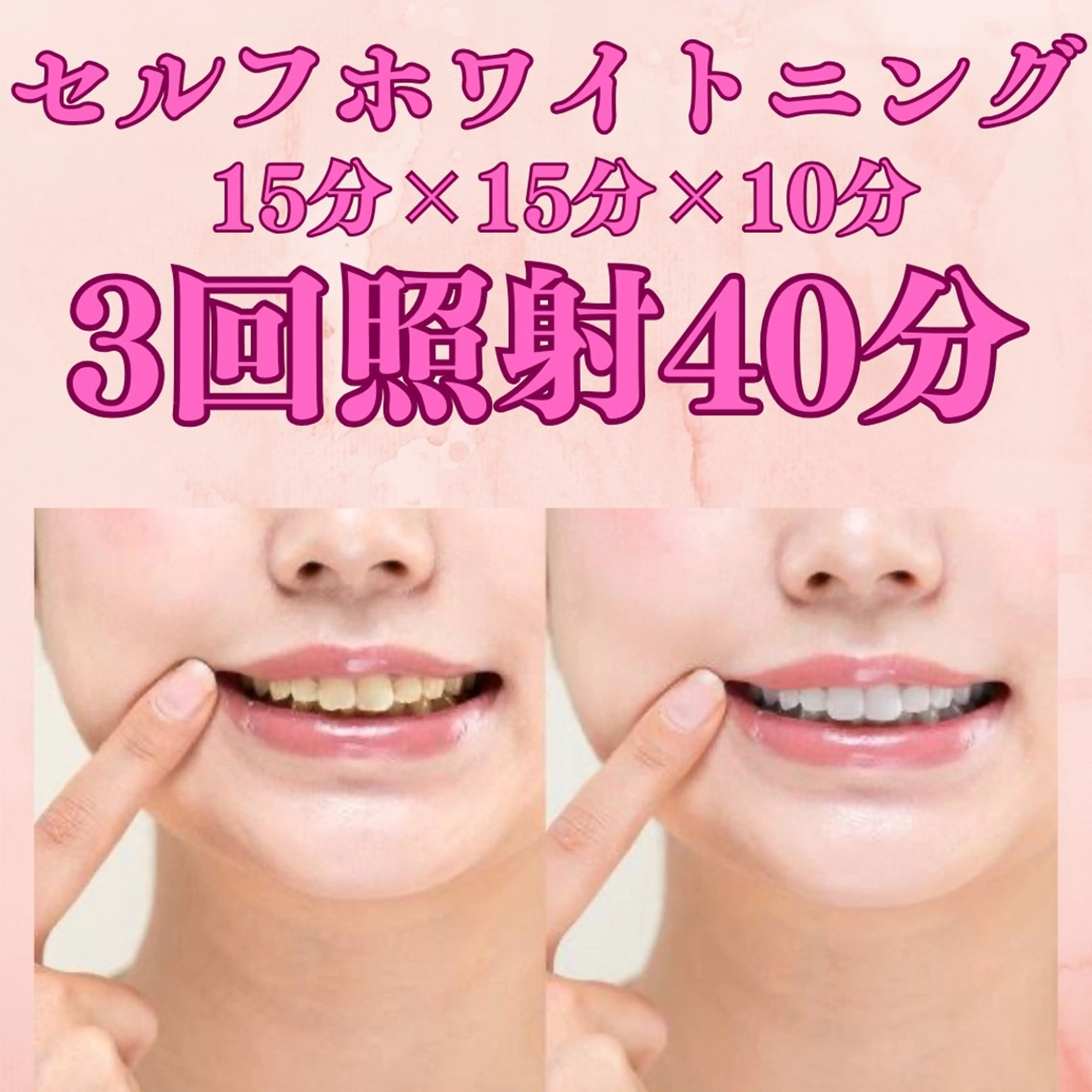メンズ その他 soerute所属・オーラルケアサロン soeruteのその他イメージ