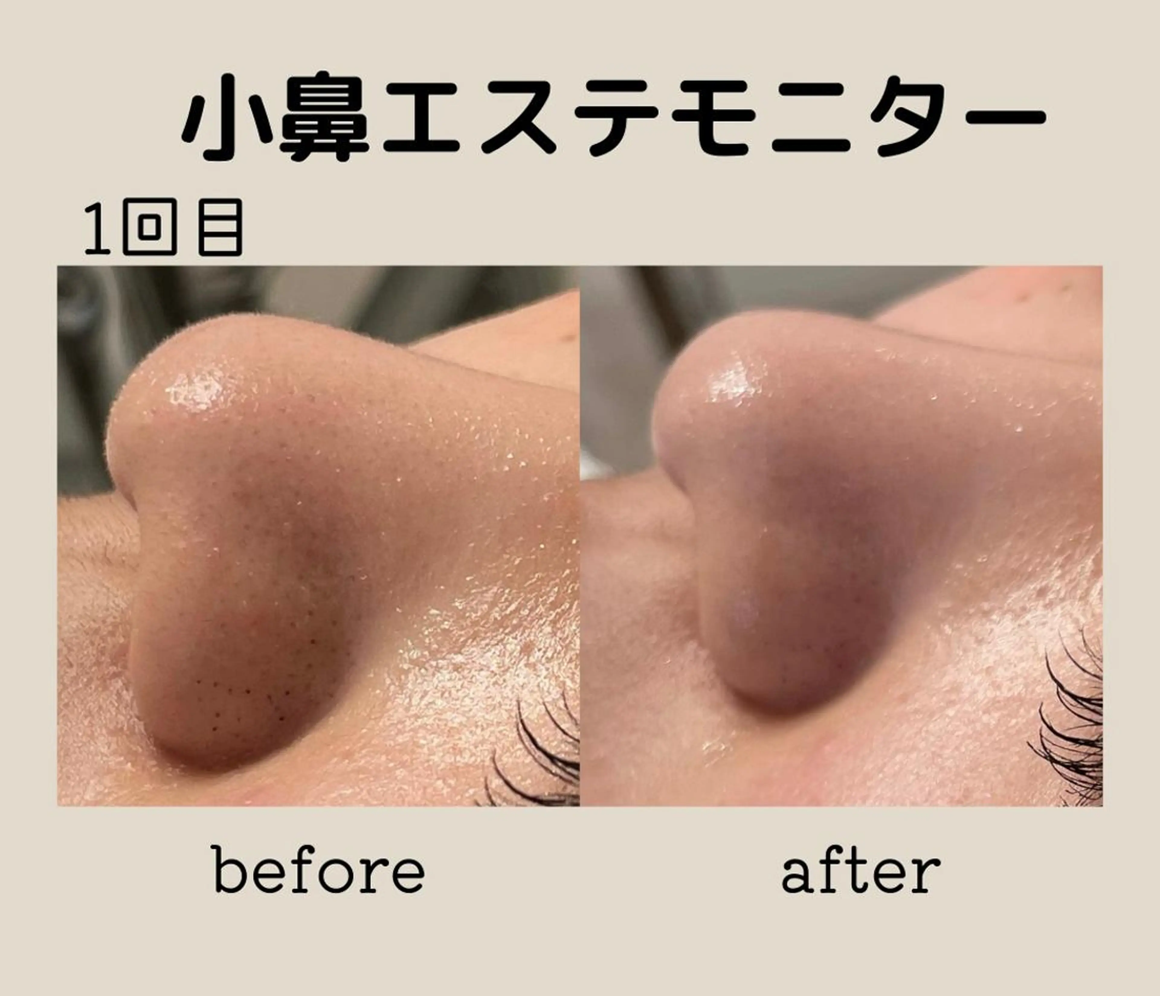 エステ DeI'm   名古屋栄所属・小林 玲菜のエステ・リラクイメージ