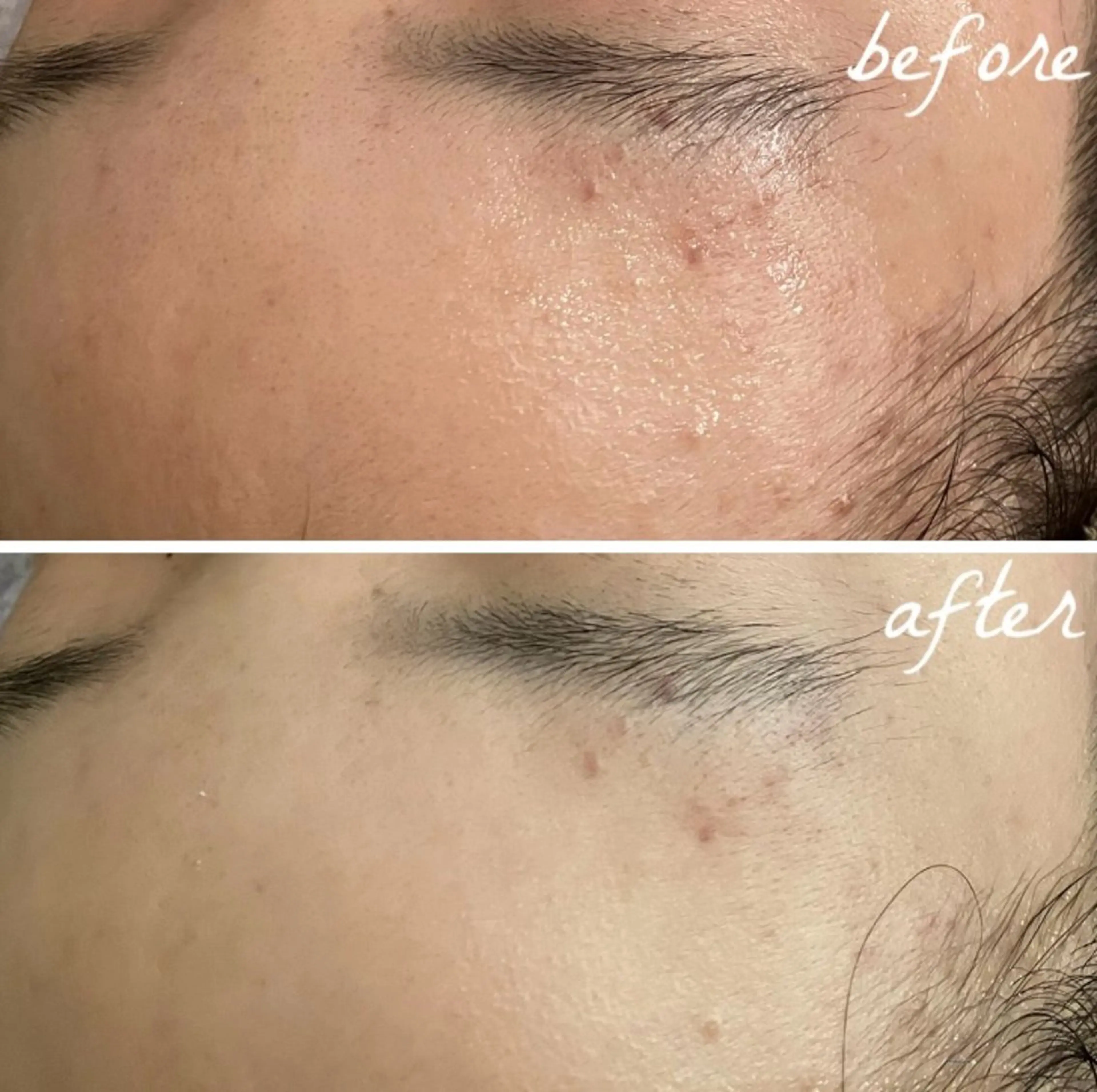 メンズ エステ メナード岐阜茜部 杉浦のエステ・リラクイメージ