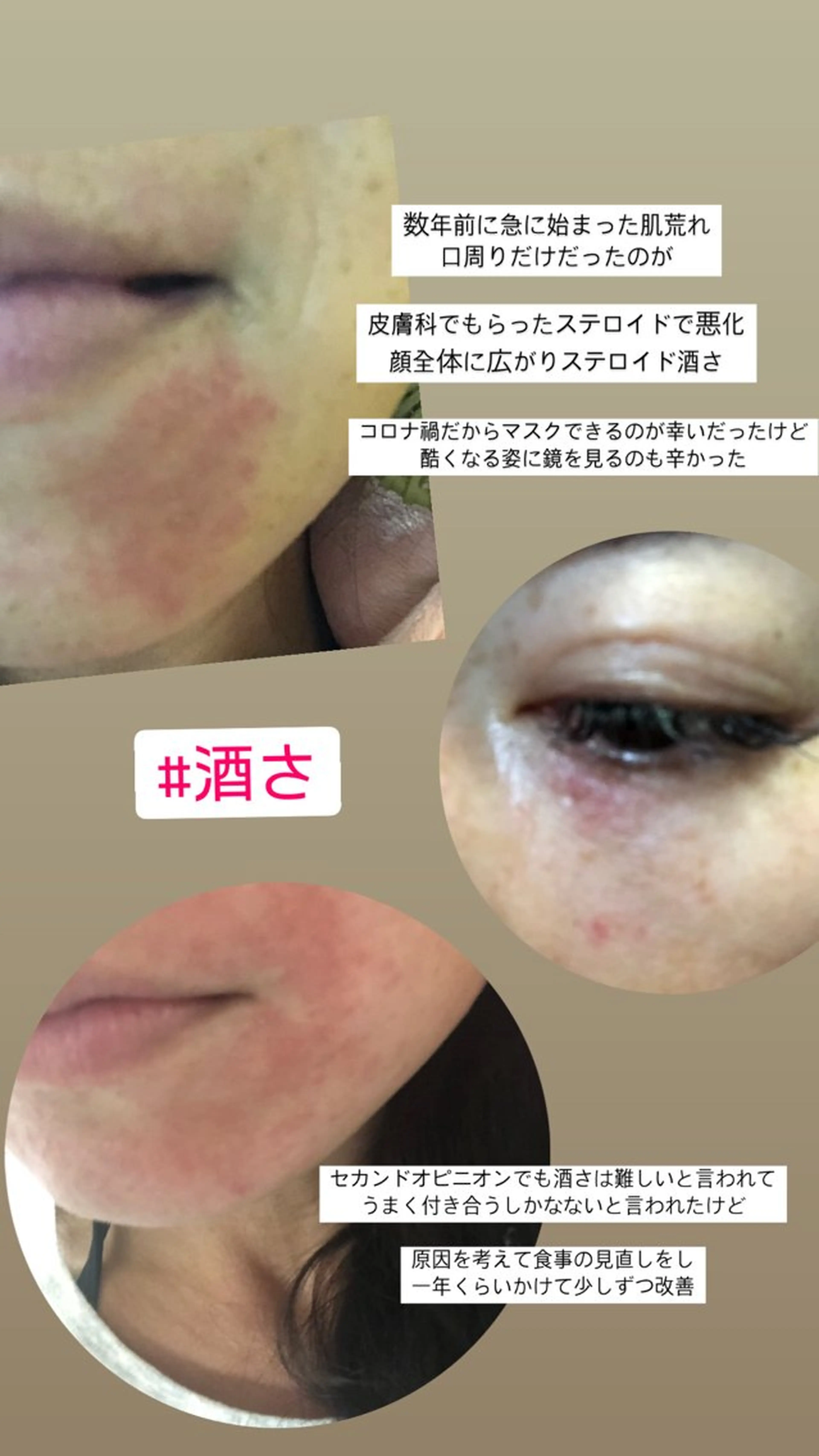 private salon  Dea_maris シュガーリング＆パーソナルボディケア所属・ダイエット難民が通う 10キロダイエットのエステ・リラクイメージ