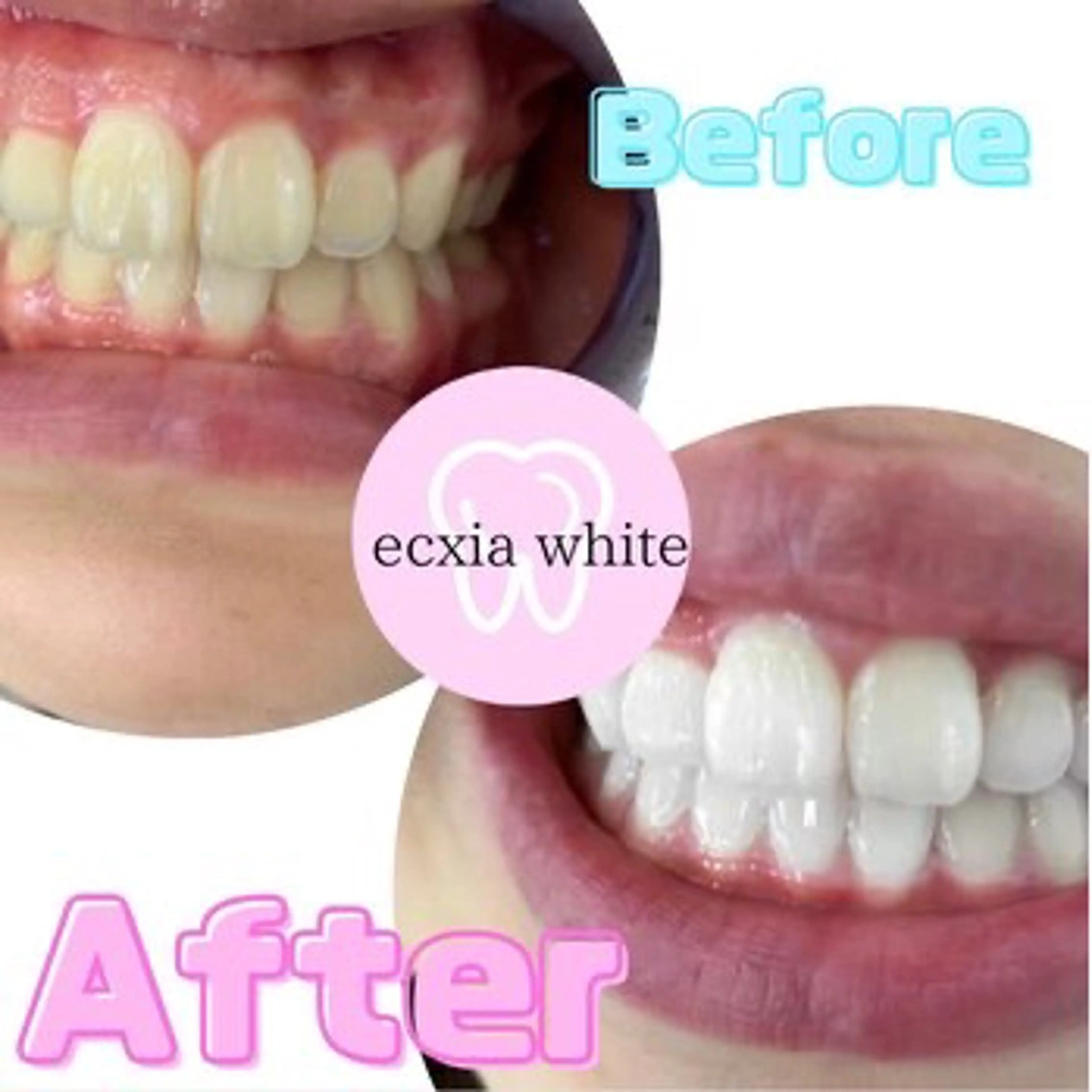 その他 ecxia white 高田馬場所属・セルフホワイトニング エクシア 高田馬場のその他イメージ