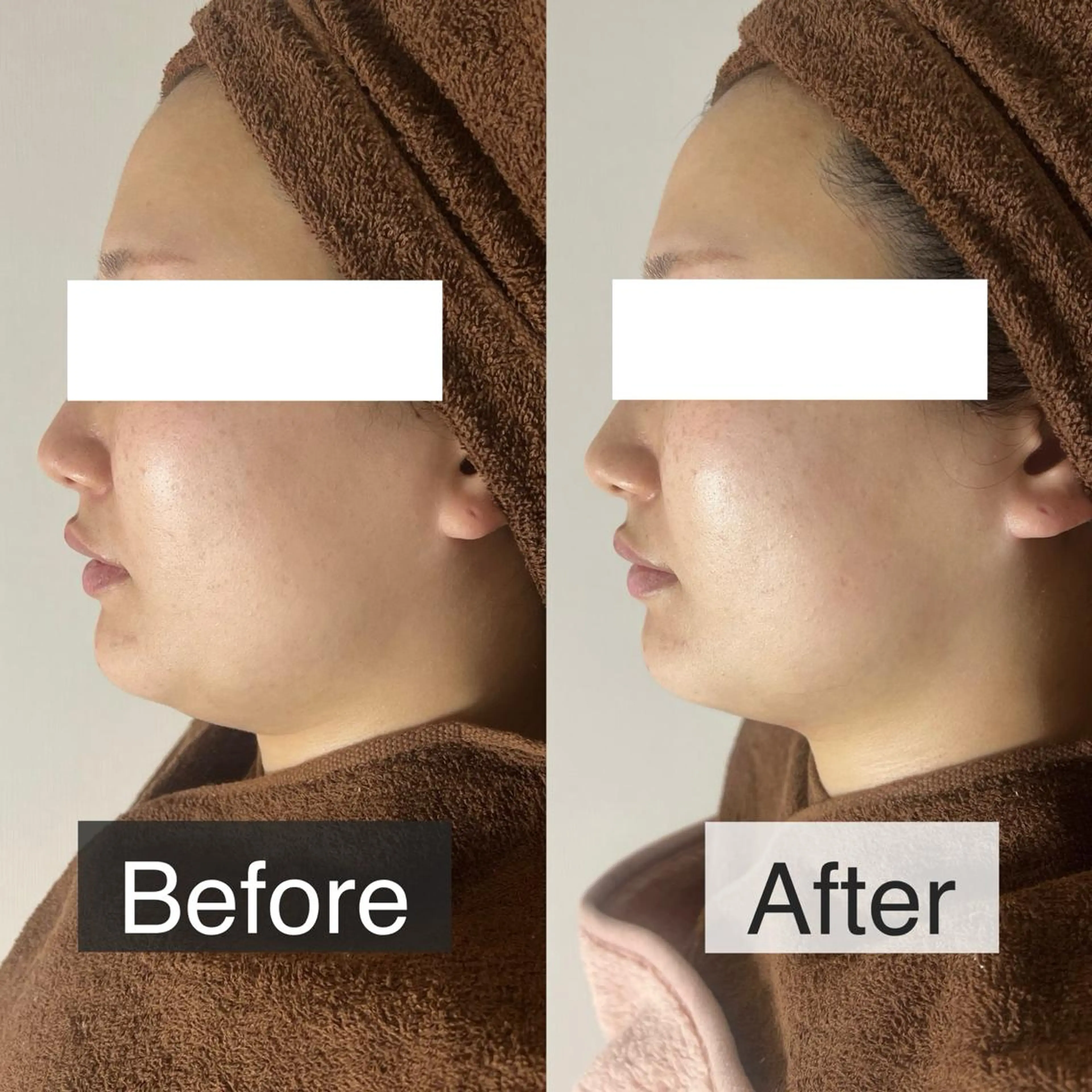 脱毛専門サロン BELFINE恵比寿のエステ・リラクイメージ