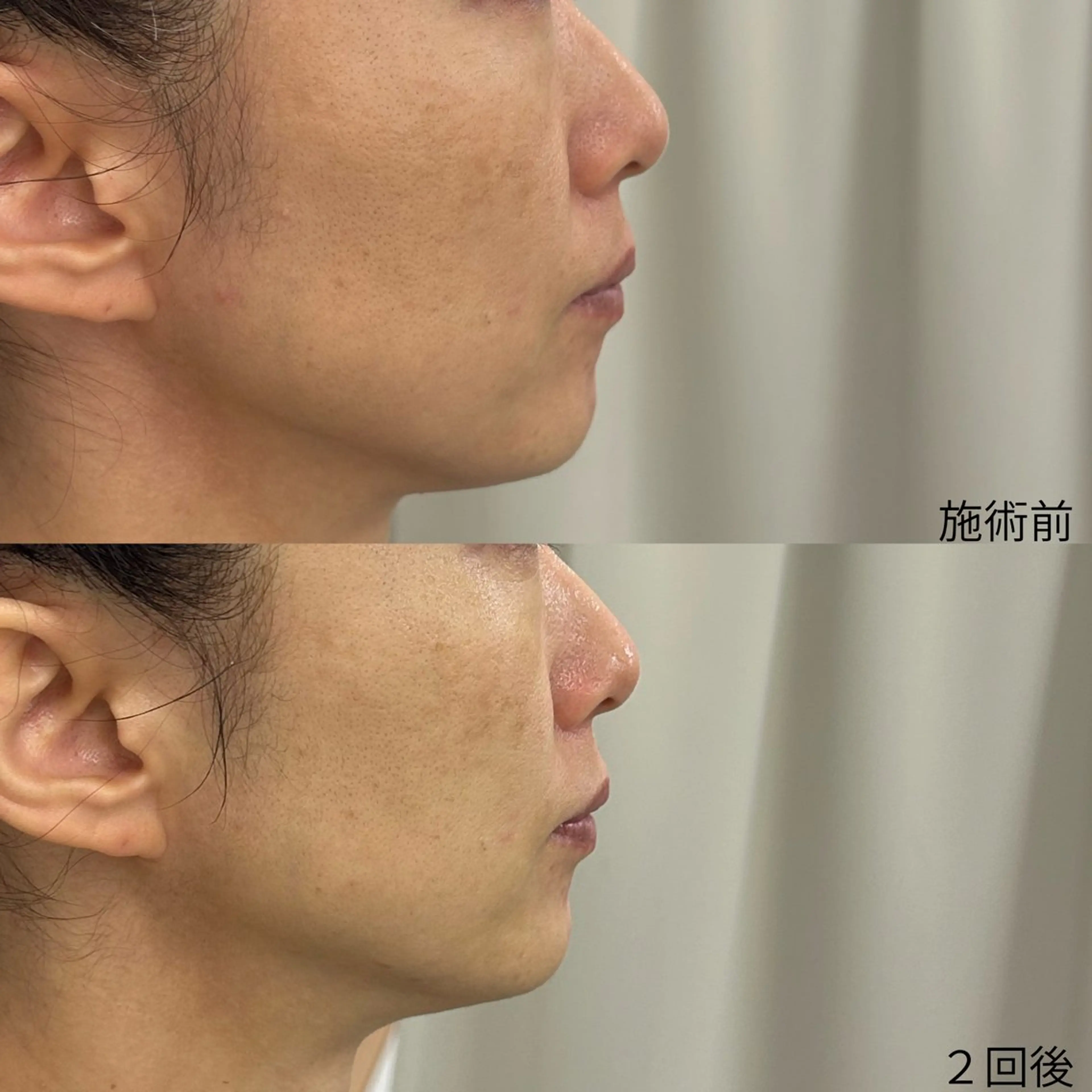 その他 Venus所属・エステサロン Venusのその他イメージ