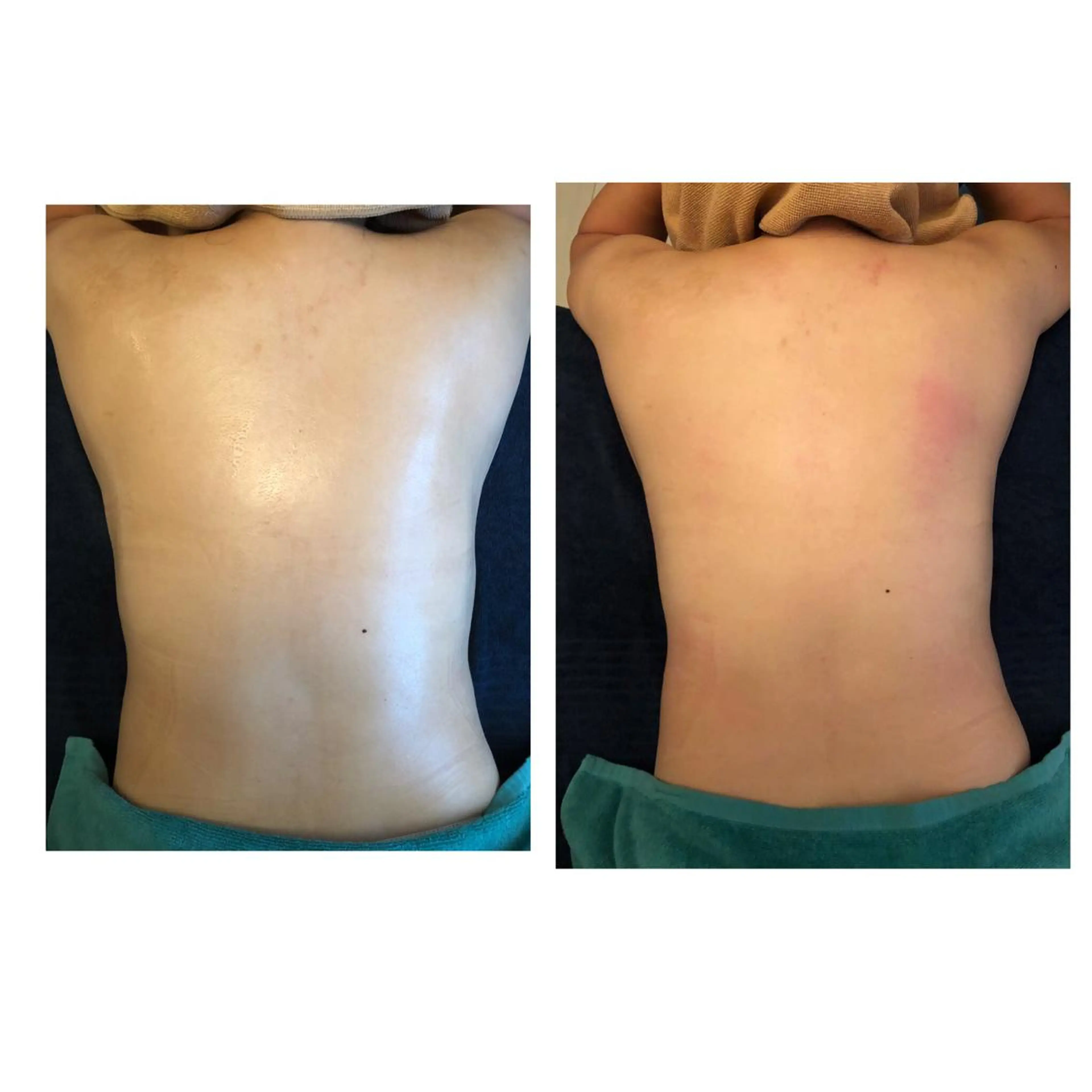 エステ リラク おうちサロン B-ROOMのエステ・リラクイメージ