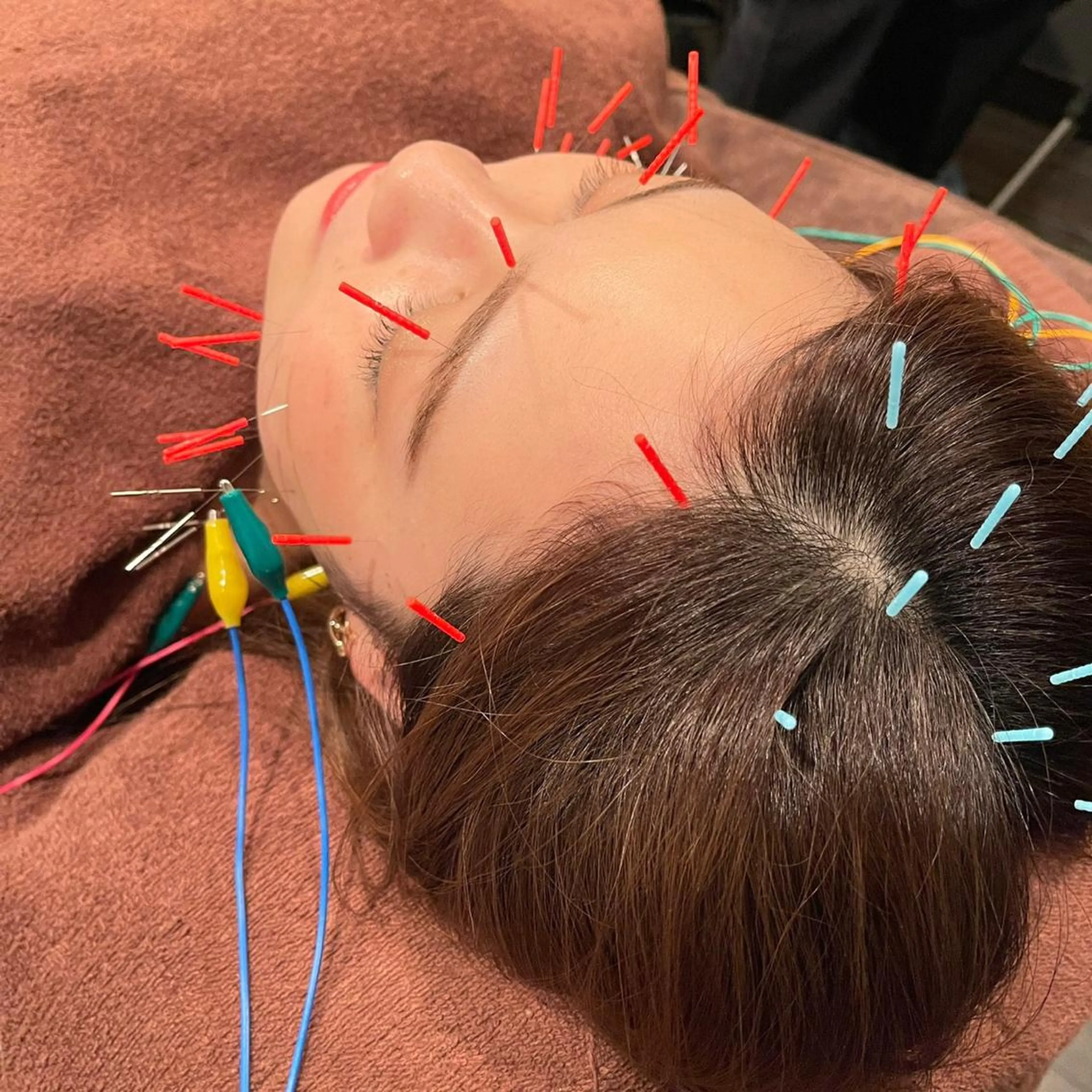 小林整骨院玉川 キジマのエステ・リラクイメージ