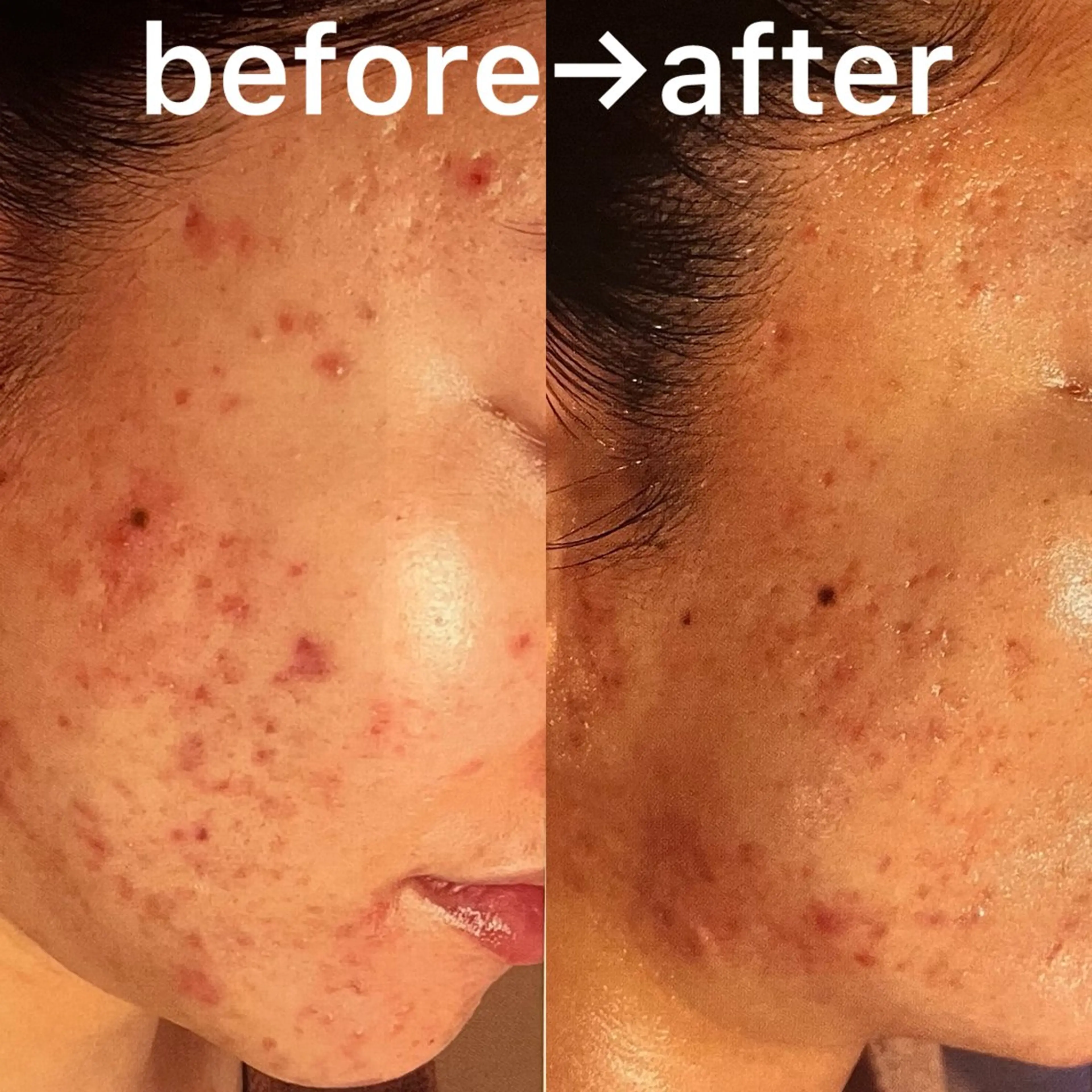 La BeIIe vie所属・LaBeIIevie ラベルヴィのマツエク・マツパデザイン