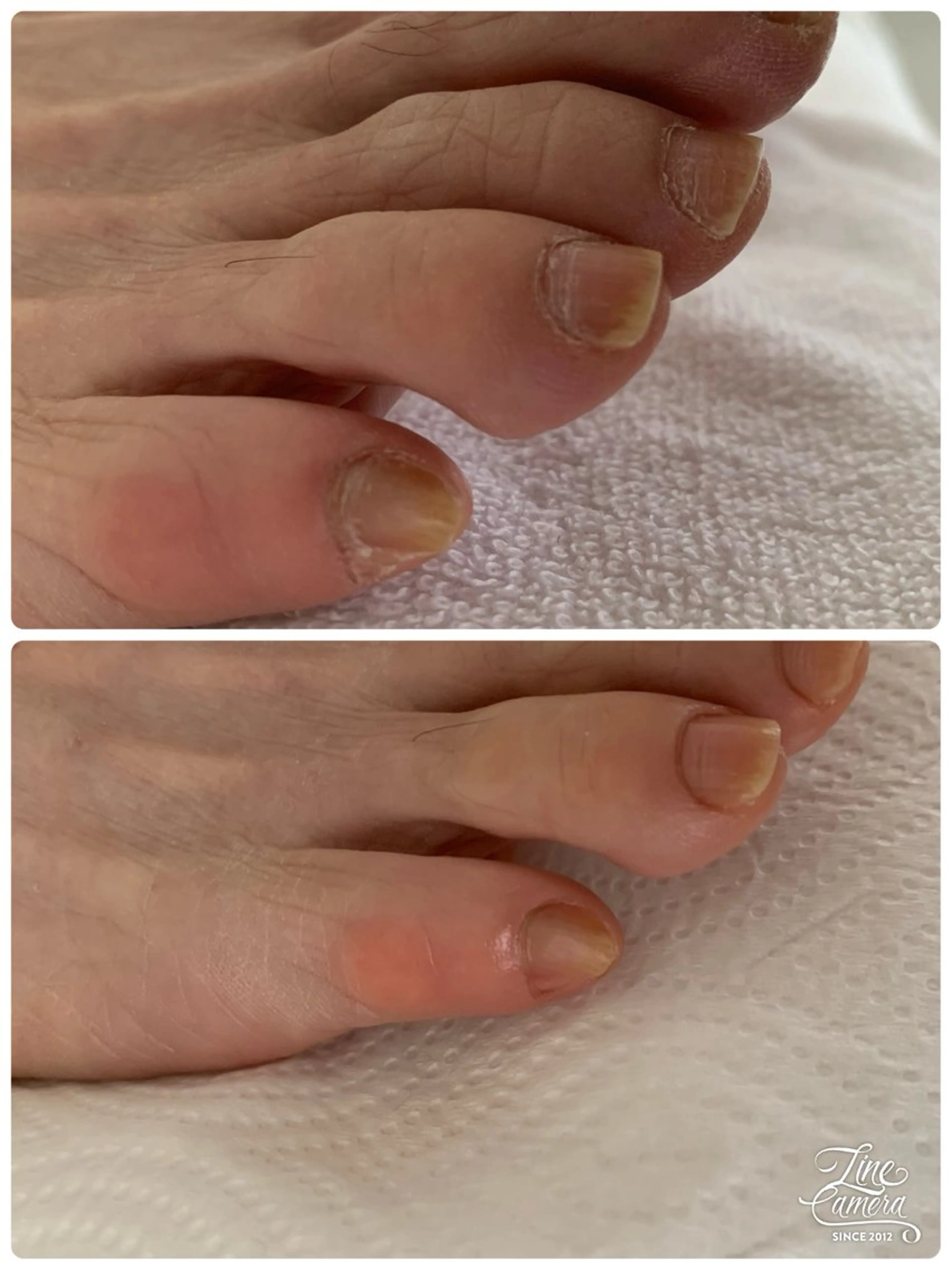 ネイル フットネイル Alo.nail アロ•ネイルのネイルデザイン
