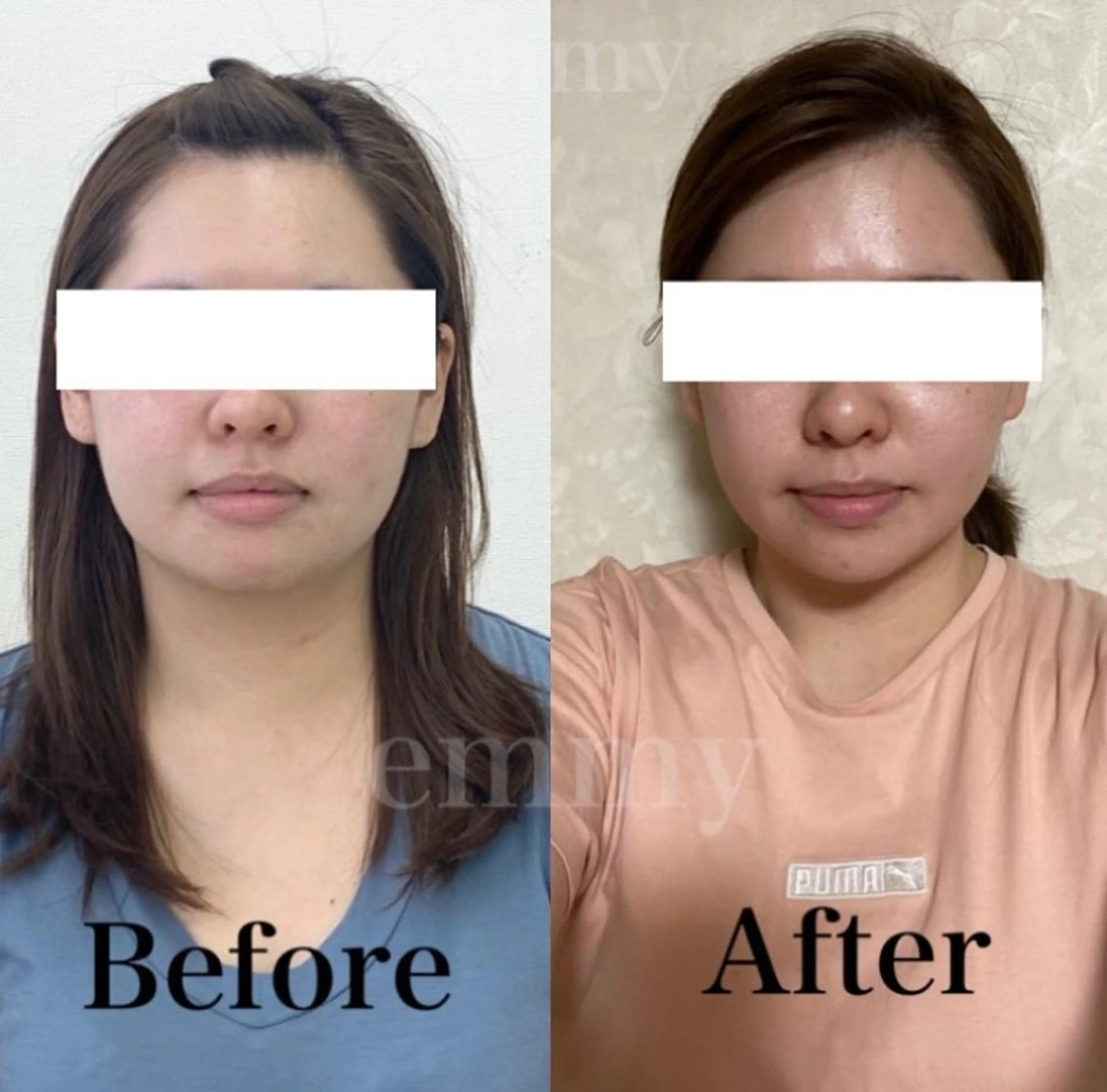 エステ リラク 小顔と ヘッドスパのお店のエステ・リラクイメージ