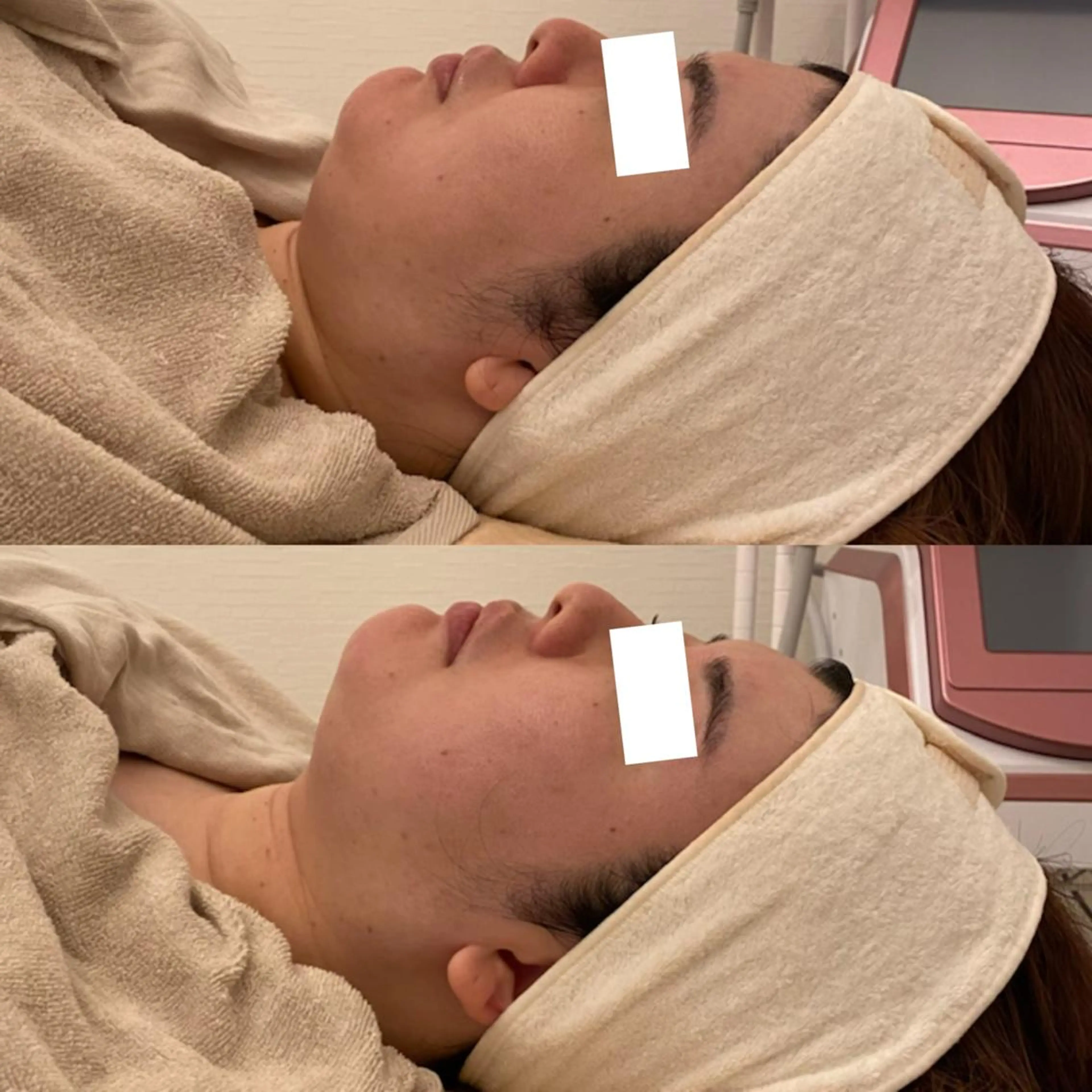 ✨美肌水光✨ アトリエリュバンのエステ・リラクイメージ