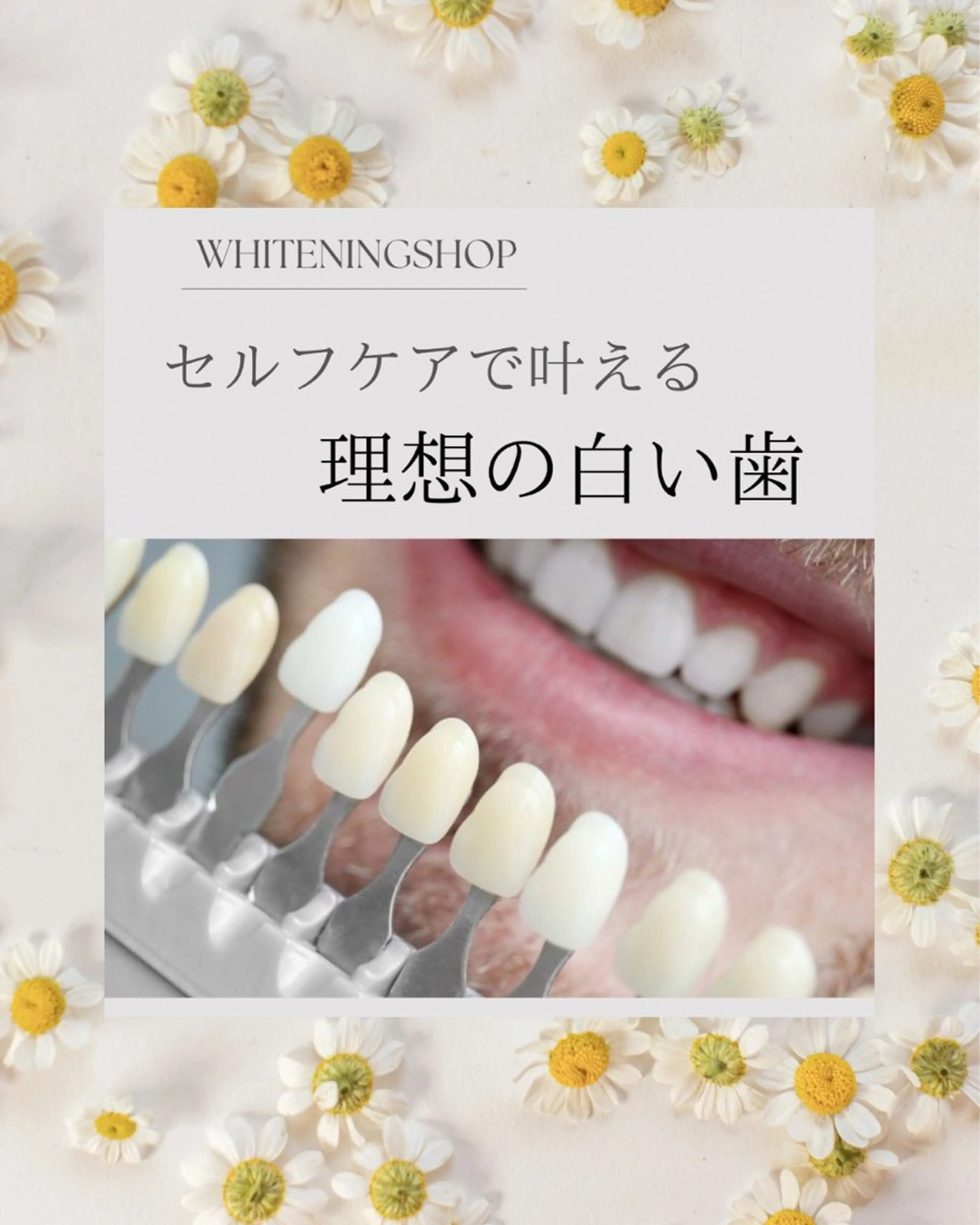 ホワイトニングショップ静岡葵区店所属・ホワイトニング ショップ静岡葵区店のその他イメージ