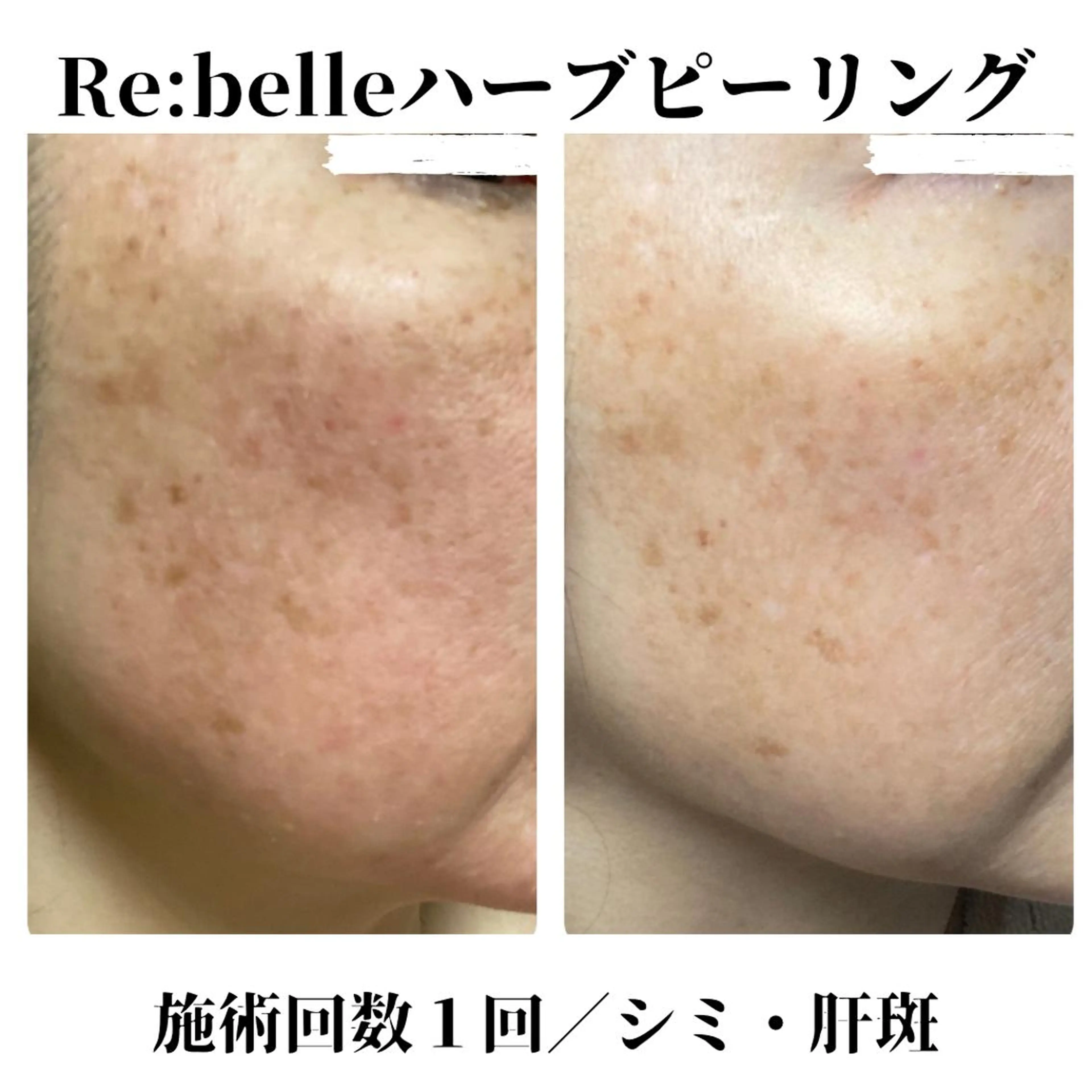 トータルビューティー サロンSalaのその他イメージ