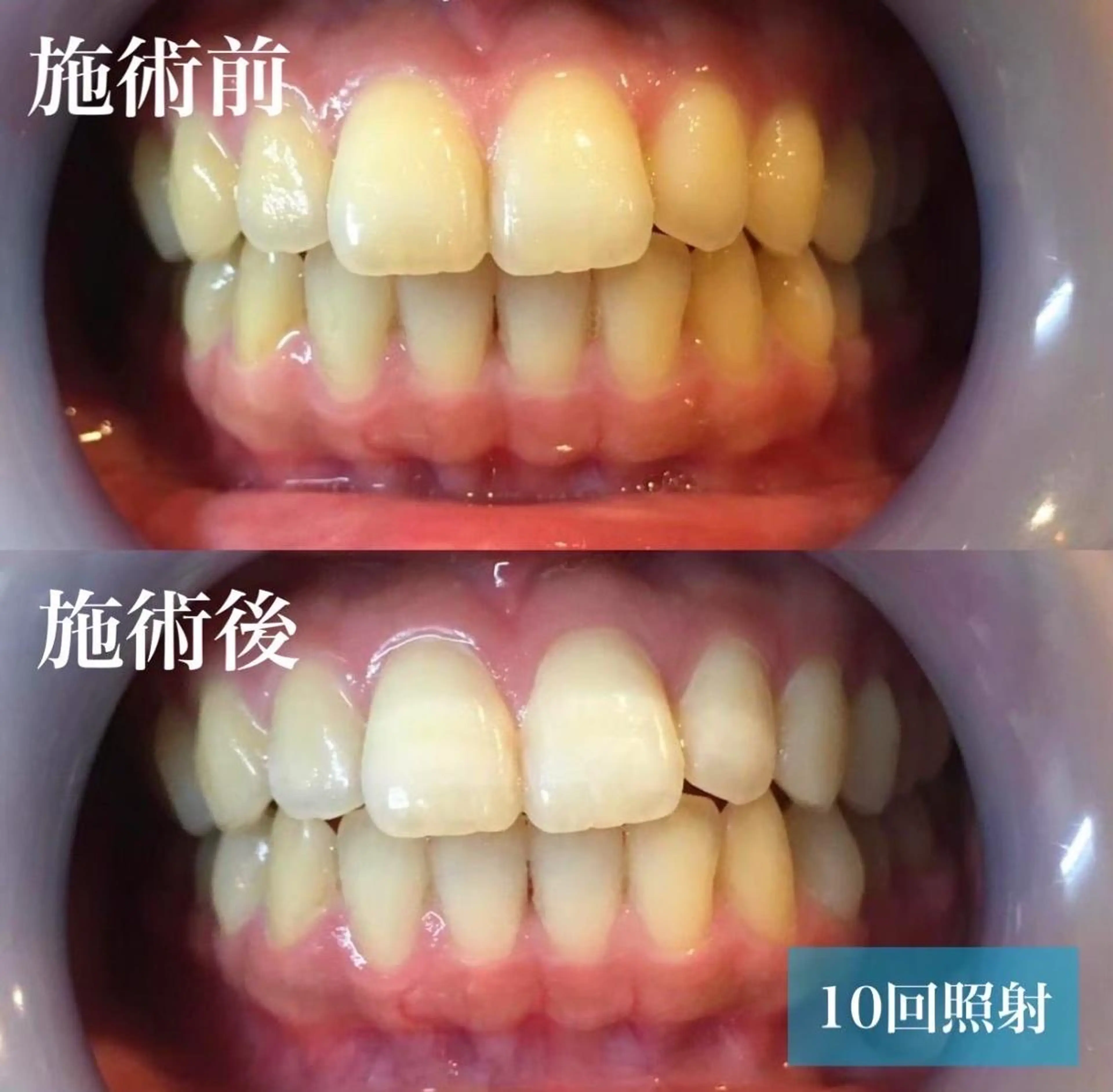 ヘアアレンジ メンズ ネイル マツエク・マツパ アイブロウ 結婚式・ブライダル メンズアイブロウ 結婚式・ブライダル メンズネイル ブライダルネイル エステ リラク LBSホワイトニング 銀座店💎店長浦和のその他イメージ