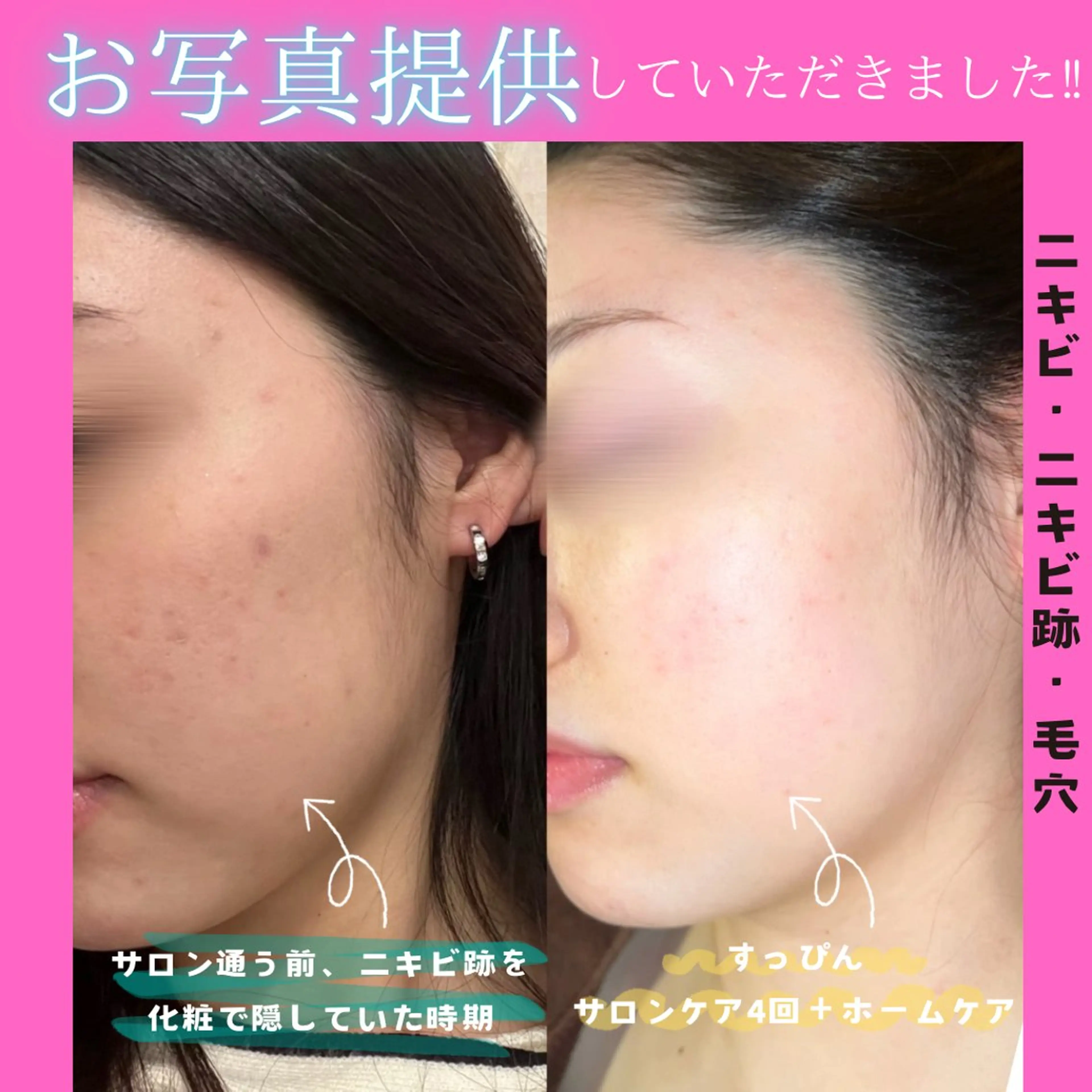 エステ リラク 痩身&美肌サロン 堀米✨のエステ・リラクイメージ