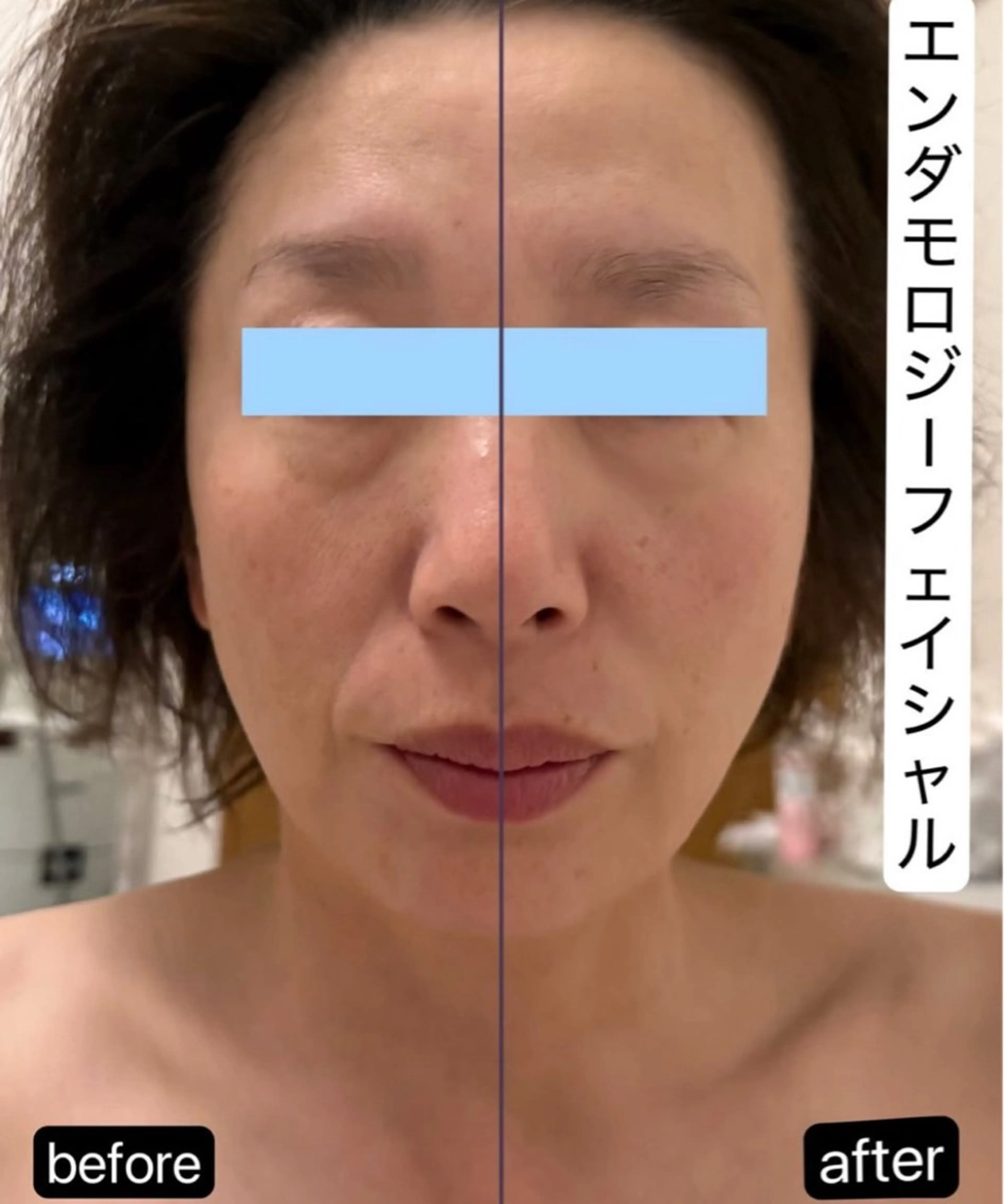 エステ Binosu所属・エンダモロジー BINOSUのエステ・リラクイメージ